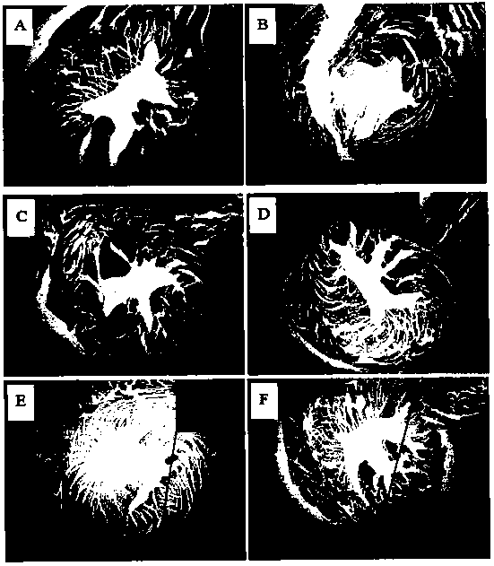 Antler protein extract and its medicinal application