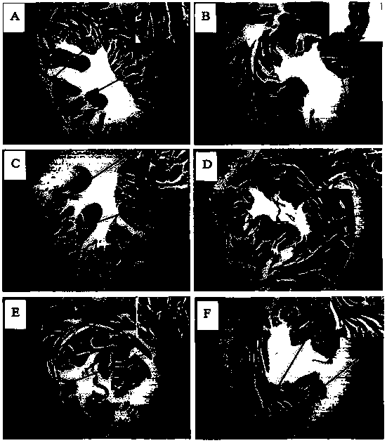 Antler protein extract and its medicinal application