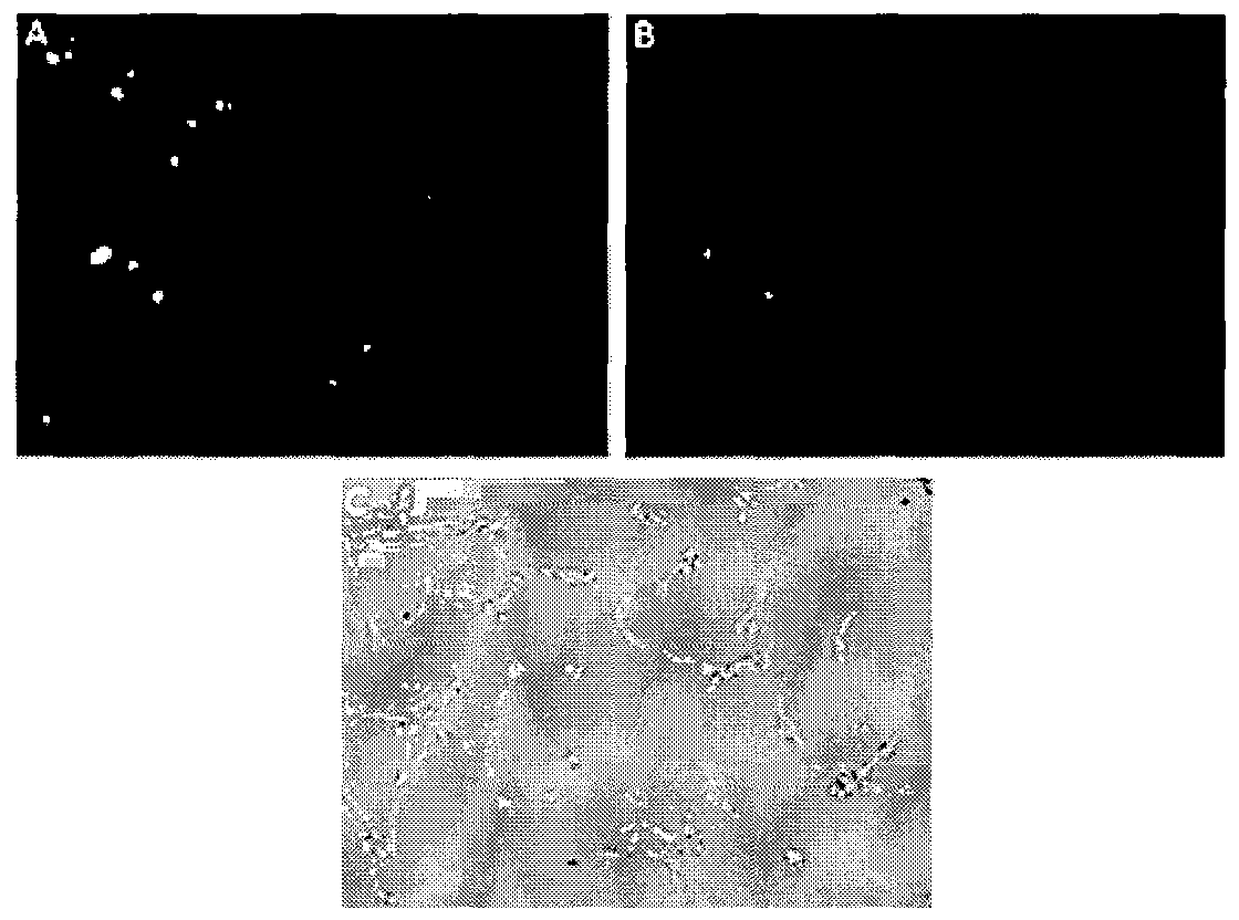 Composition based on main components of Pu'er tea and application thereof