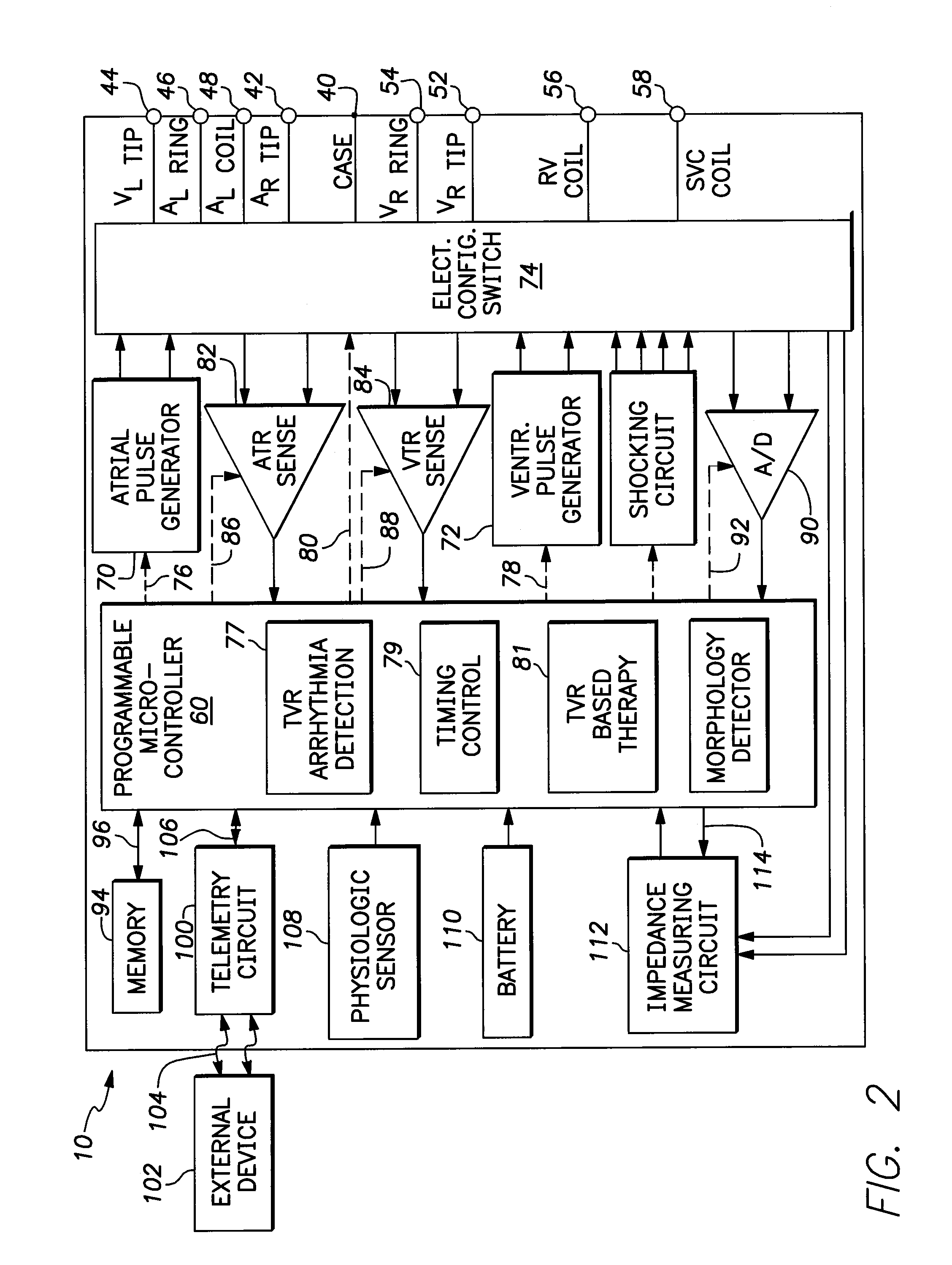 Method and system for detecting and treating junctional rhythms