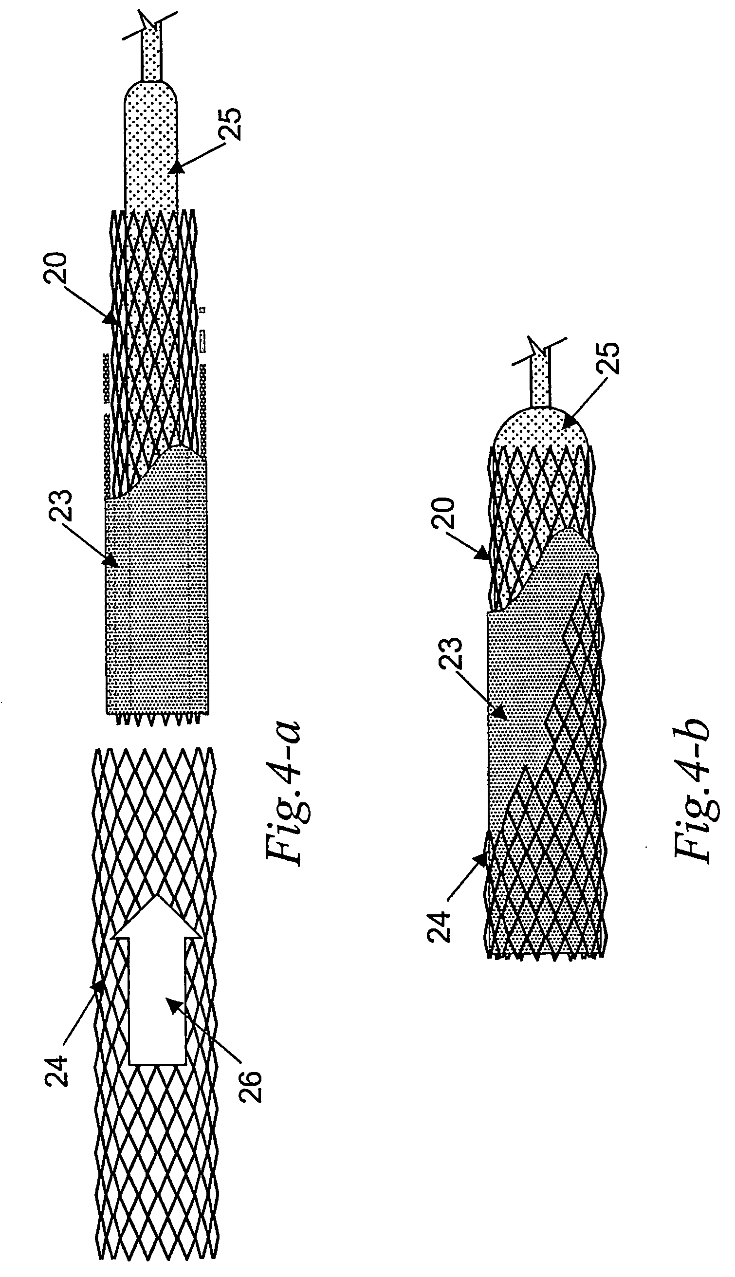 Endoprosthesis process to obtain and methods used