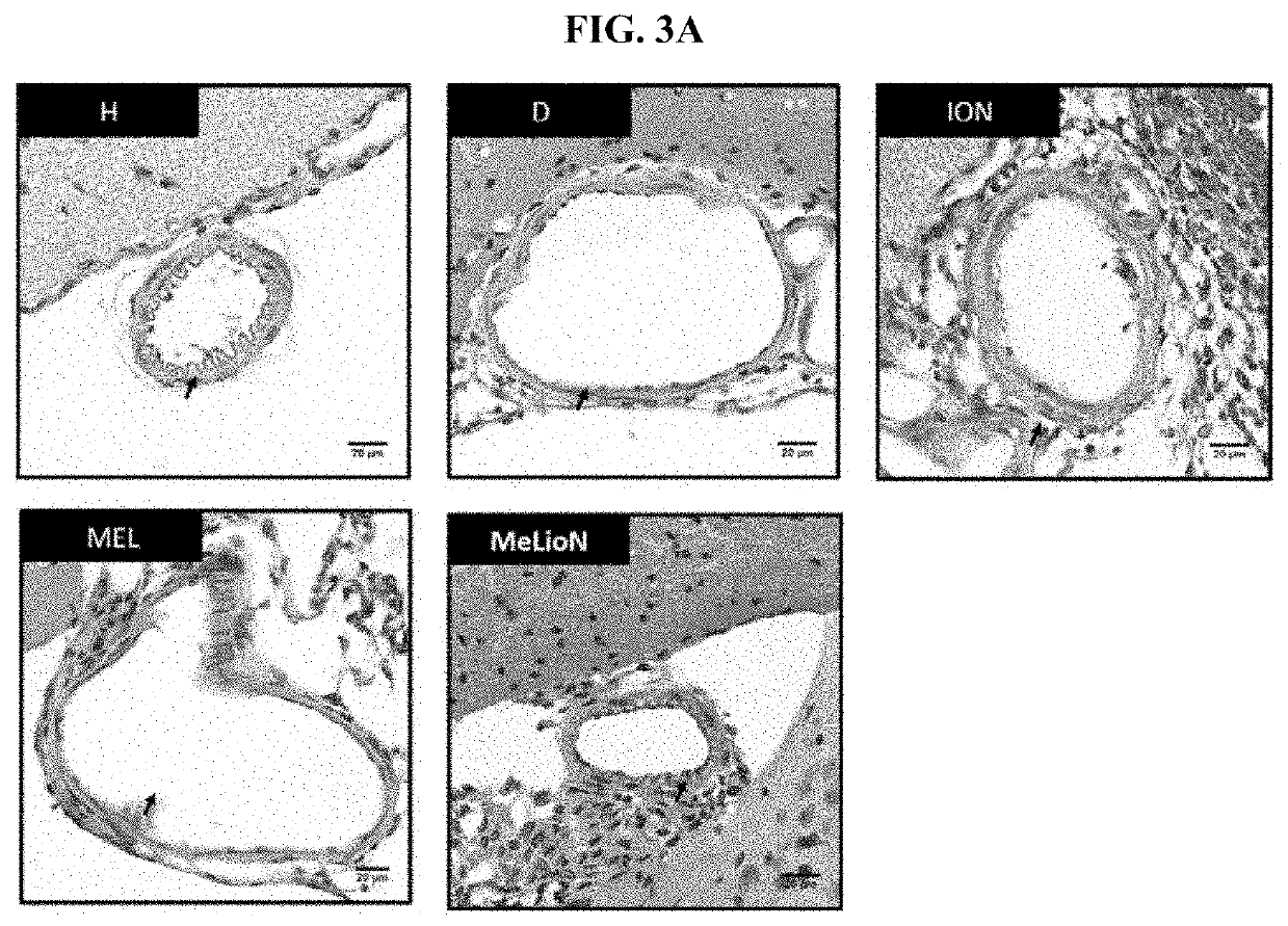 Composition for preventing, ameliorating, or treating cerebrovascular disease comprising melittin or magnetic iron oxide nanoparticle loaded with melittin as effective component