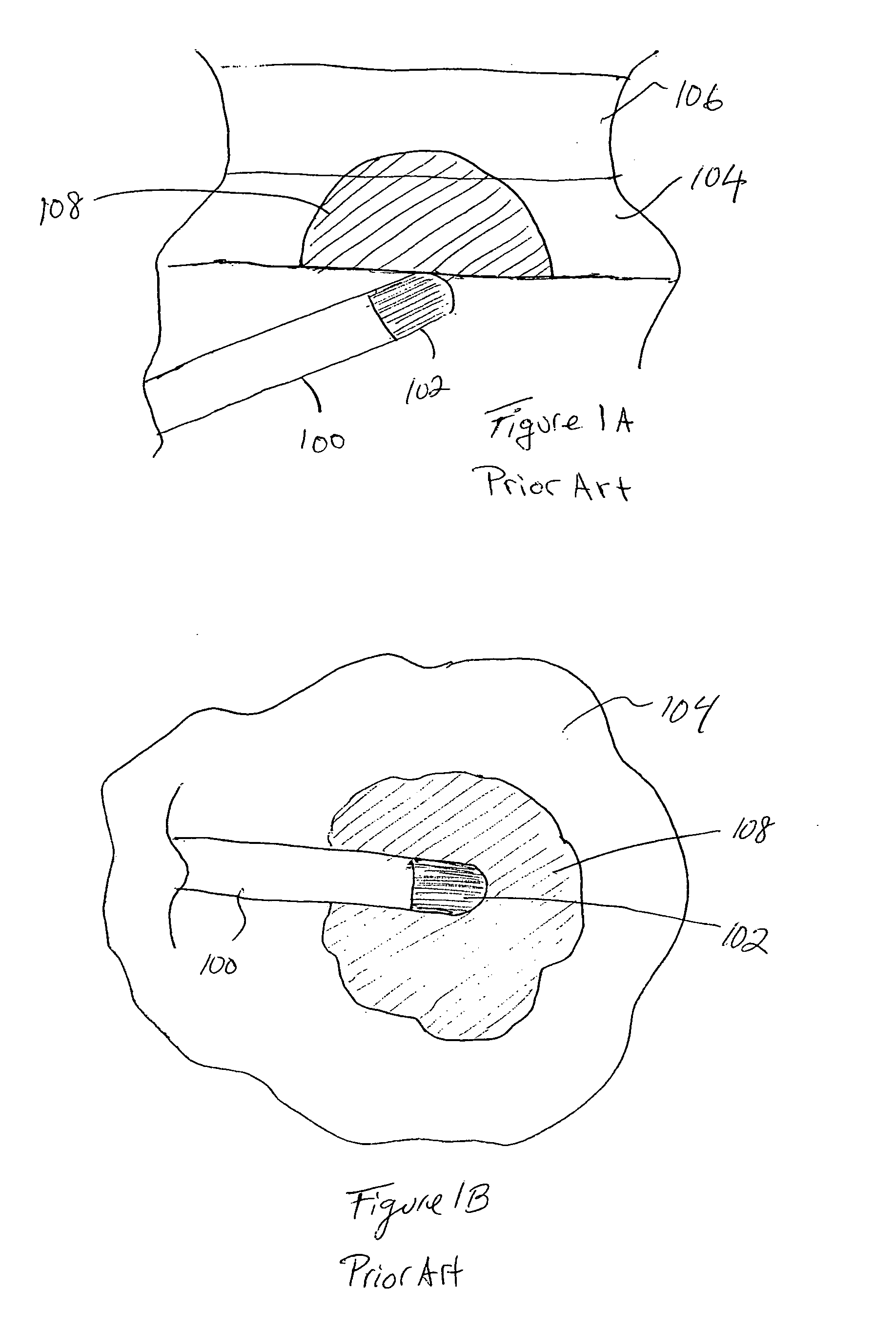 Methods and devices for creating electrical block at specific sites in cardiac tissue with targeted tissue ablation