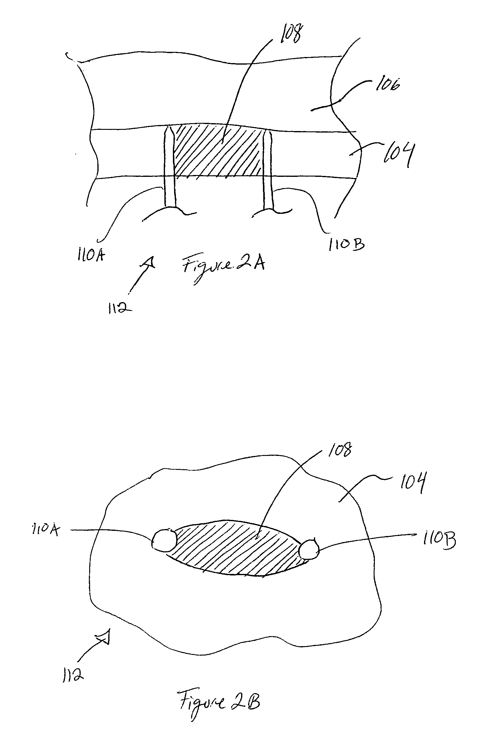 Methods and devices for creating electrical block at specific sites in cardiac tissue with targeted tissue ablation