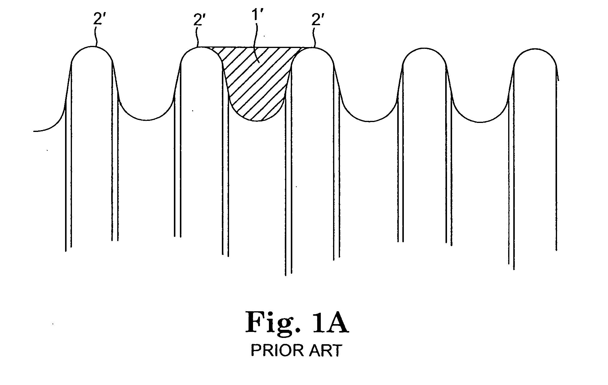 Implantable pump