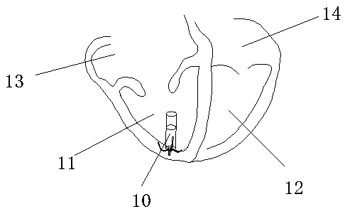 Controllable wireless cardiac pacemaker system with multi-electrode pacing