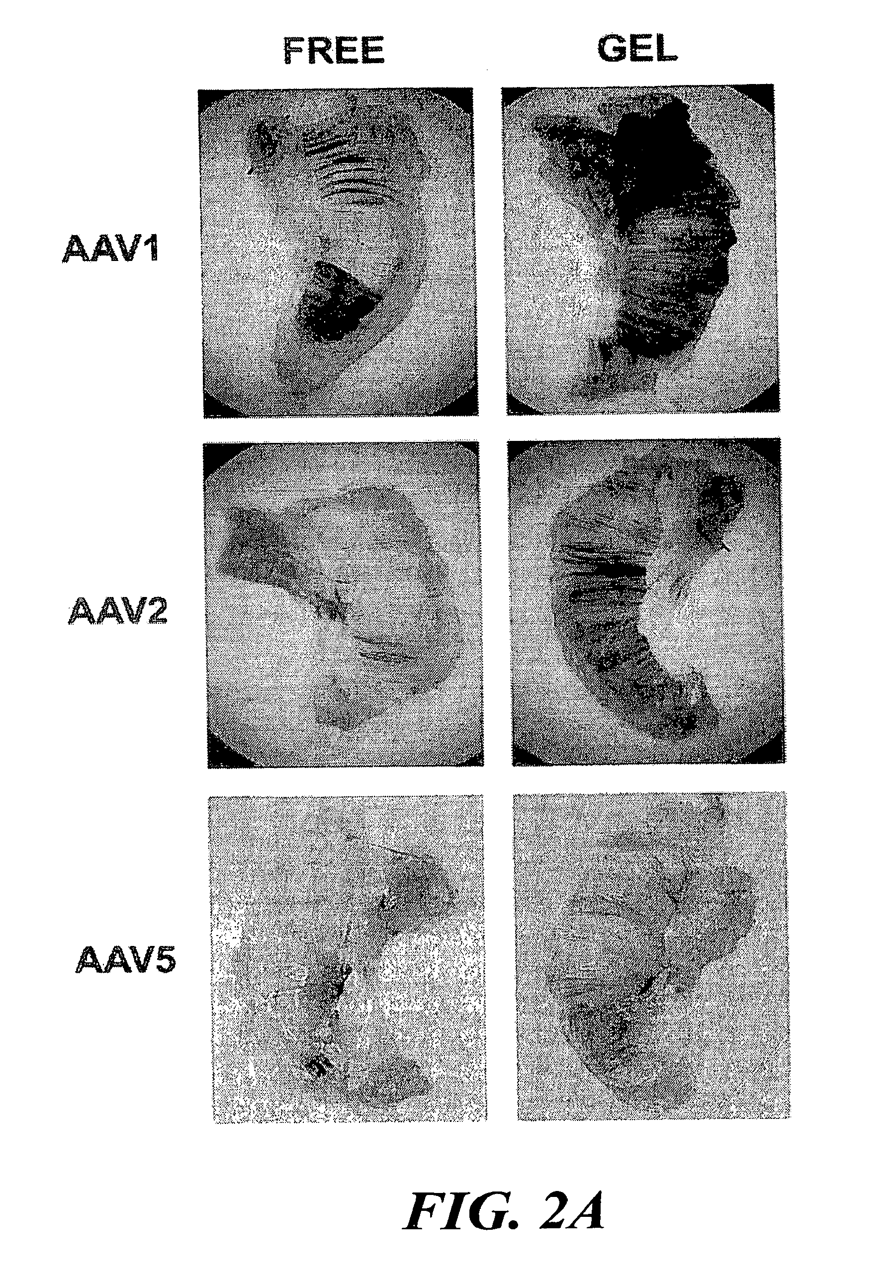 Gel-based delivery of recombinant adeno-associated virus vectors