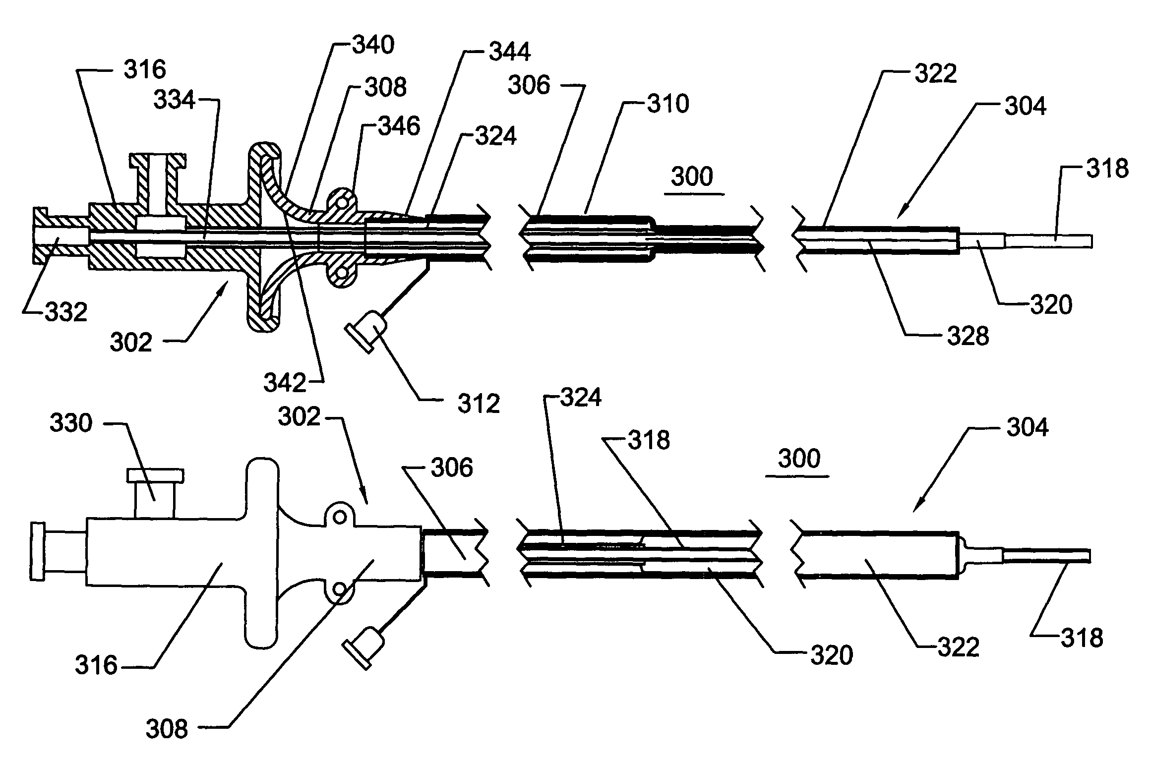 Expandable transluminal sheath