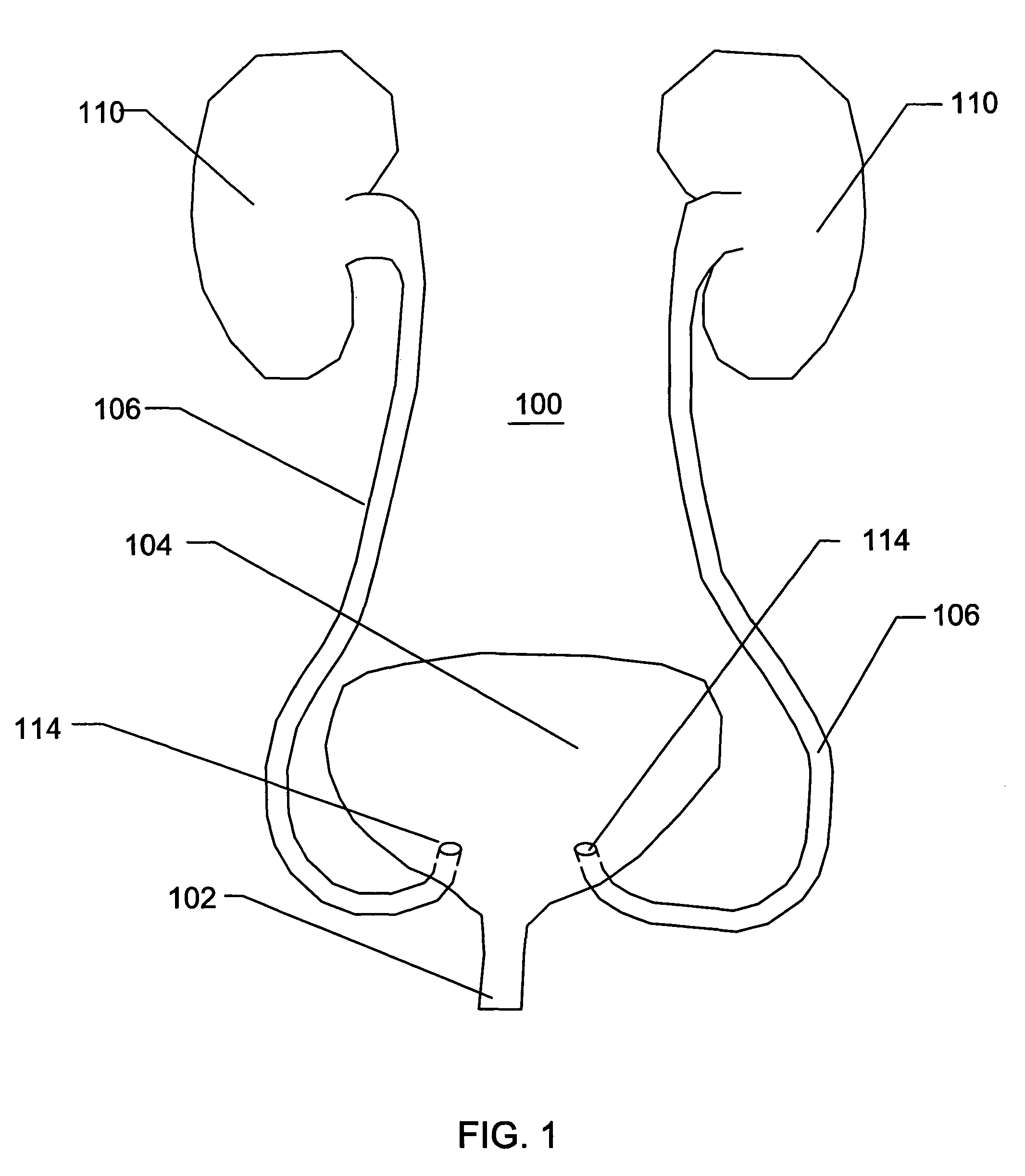 Expandable transluminal sheath