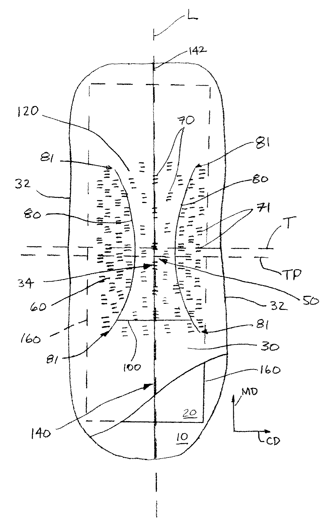 Absorbent article having a tufted topsheet