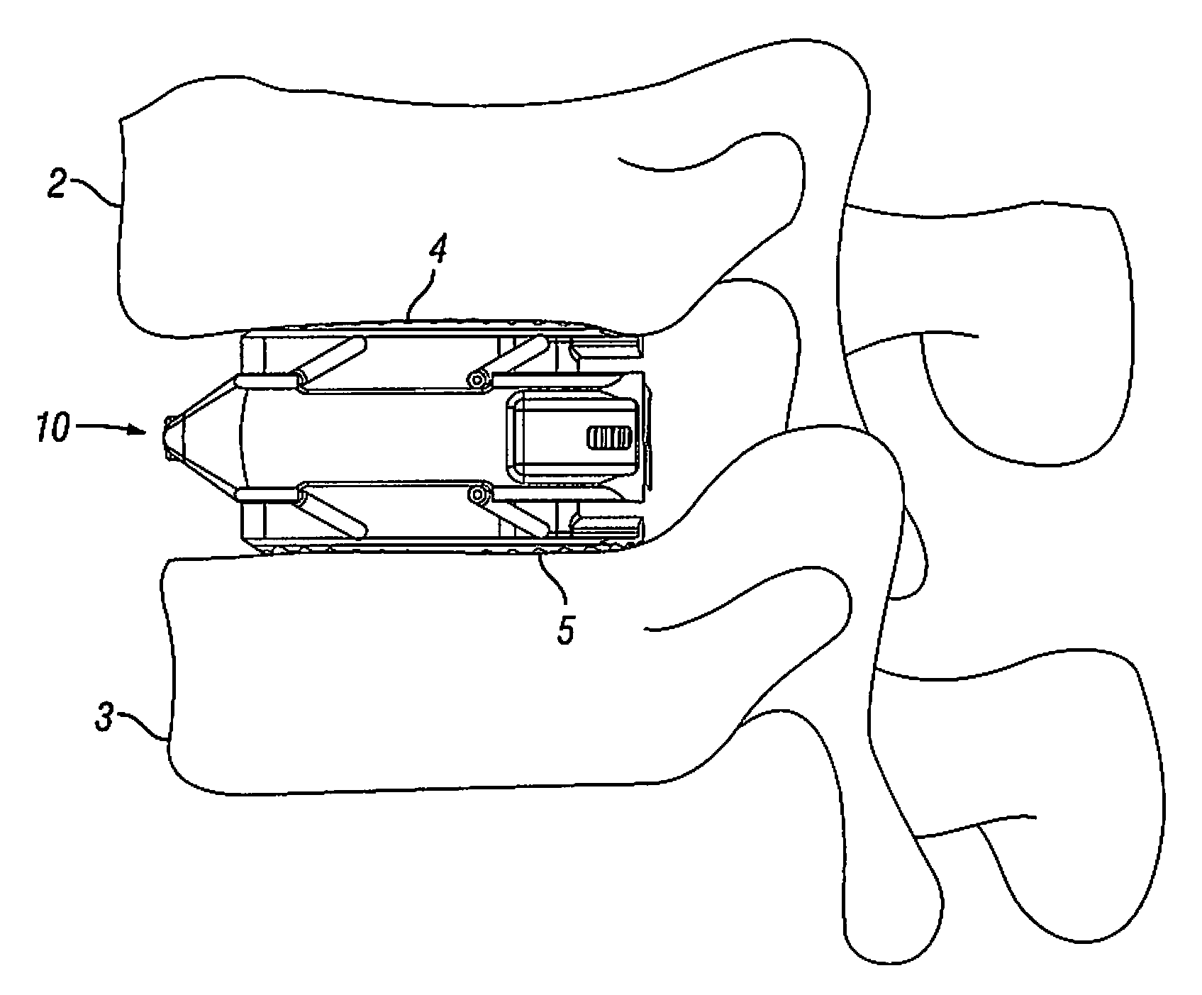 Expandable Fusion Device and Method of Installation Thereof