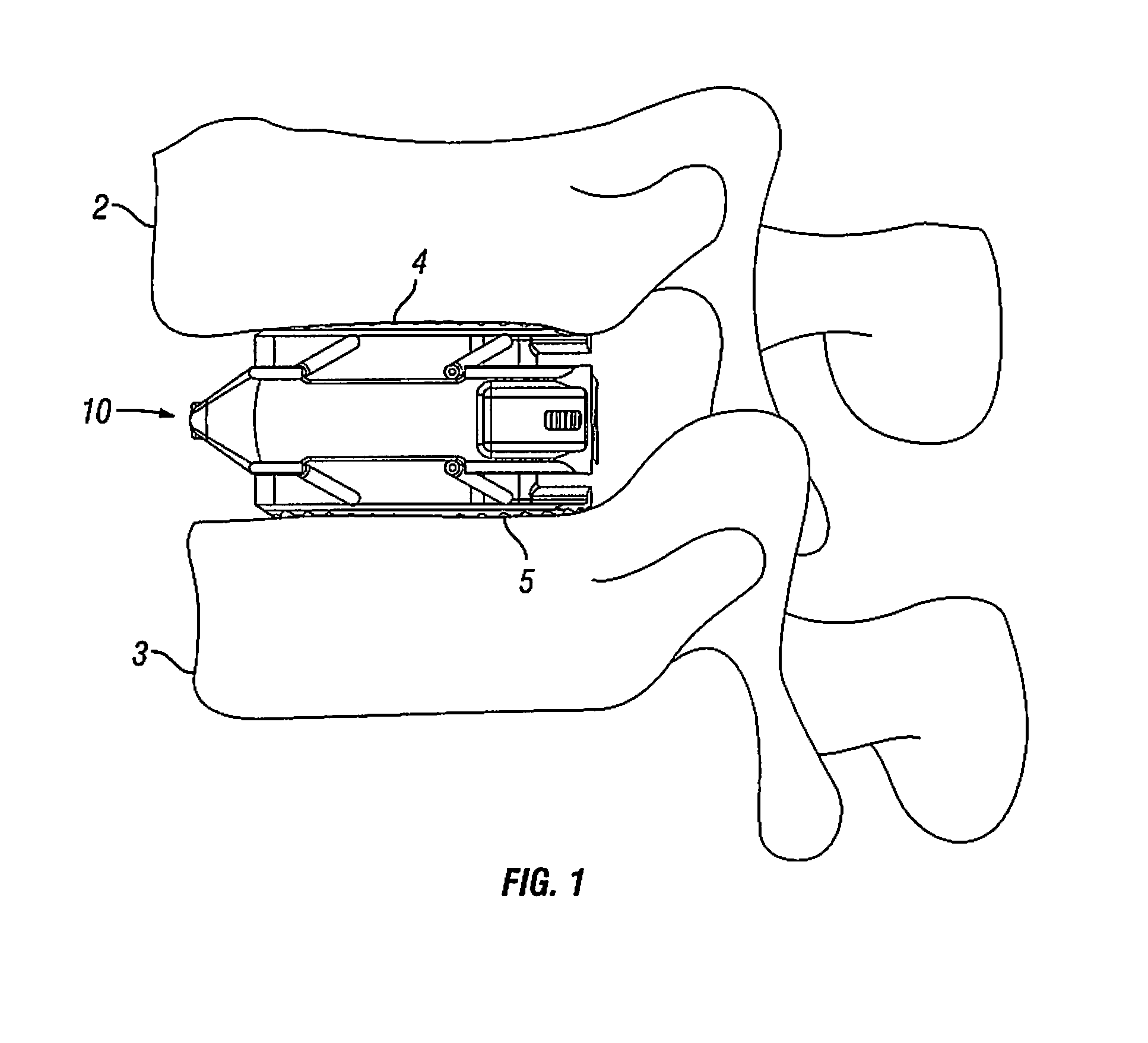 Expandable Fusion Device and Method of Installation Thereof