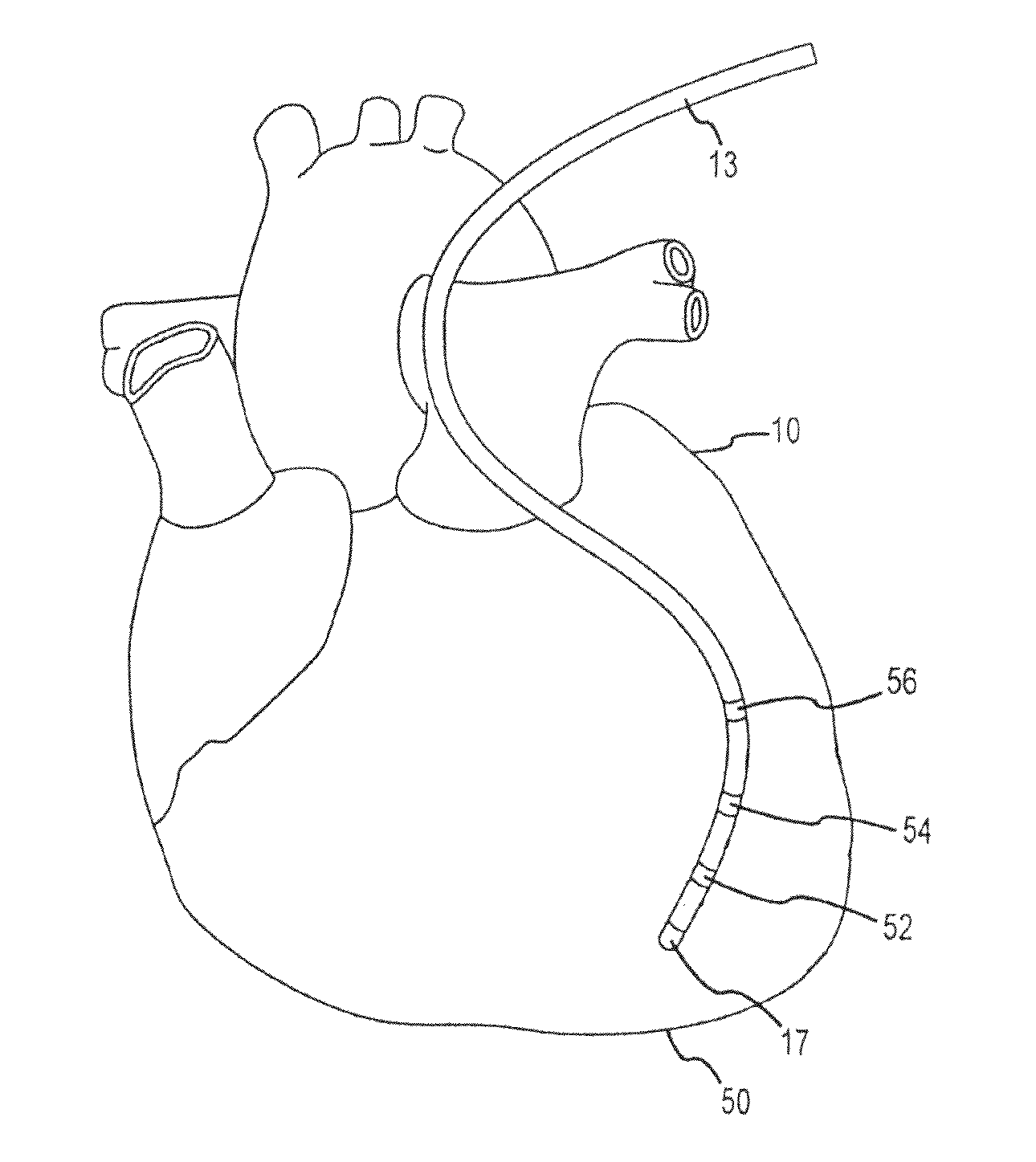 Method and system for identifying cardiac arrhythmia driver sites