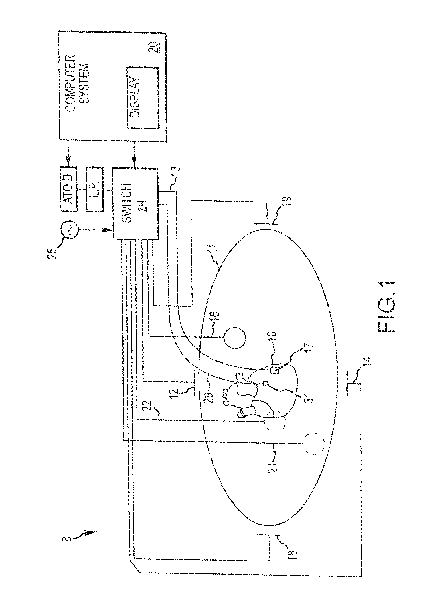 Method and system for identifying cardiac arrhythmia driver sites