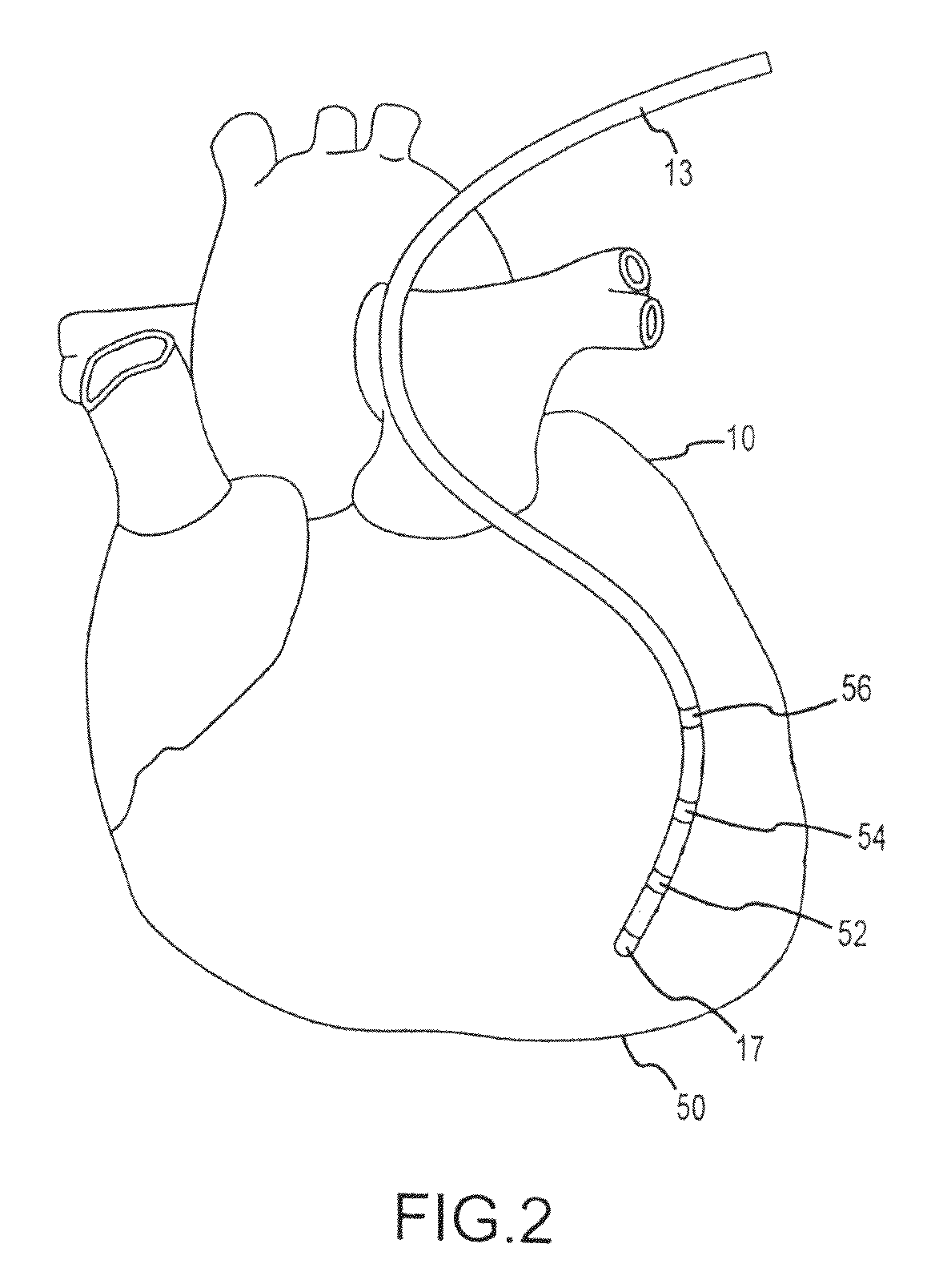 Method and system for identifying cardiac arrhythmia driver sites