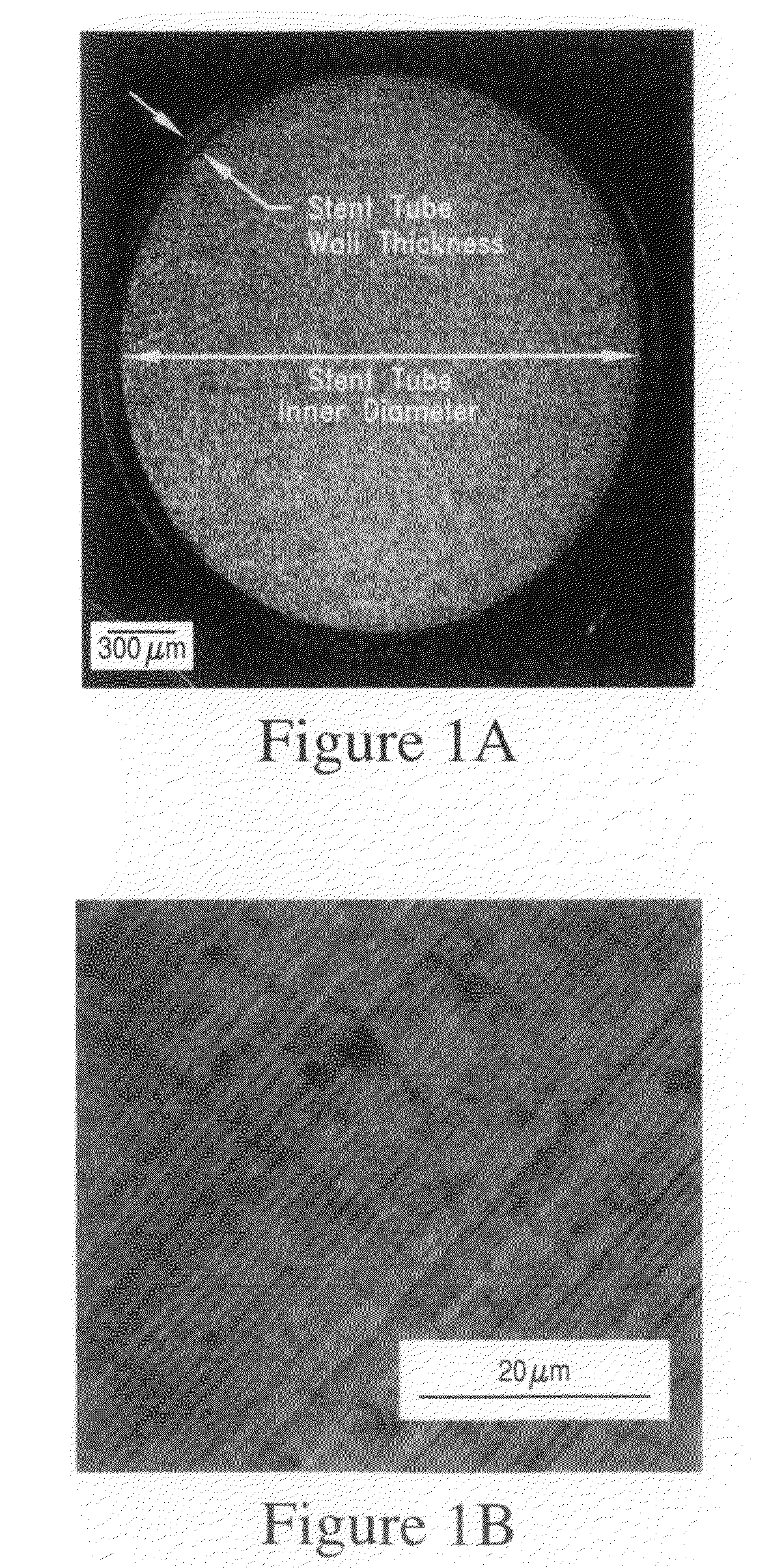 In-vivo biodegradable medical implant