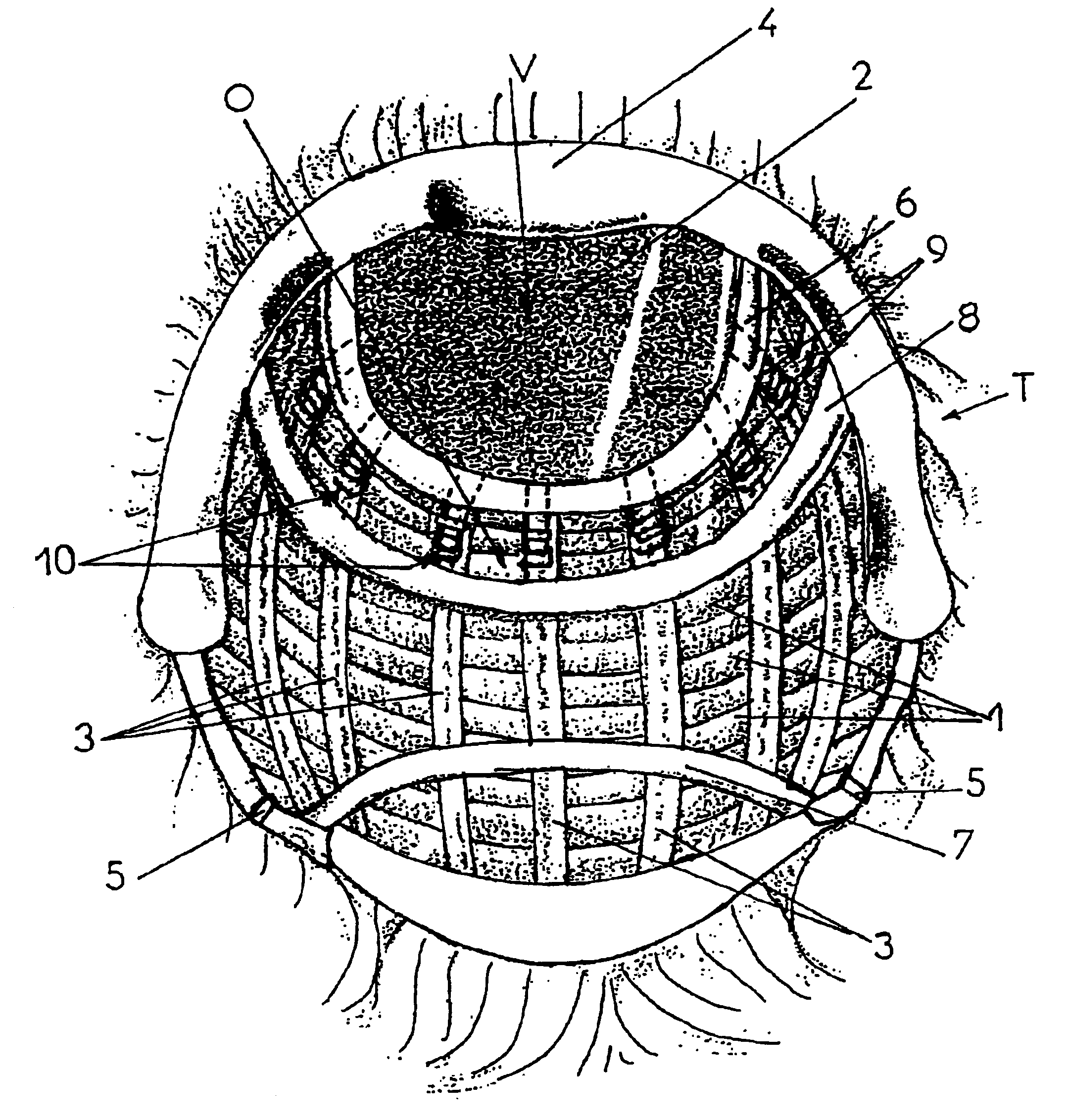 Wig adjustable to the shape of the user's head and method for carrying out said adjustment