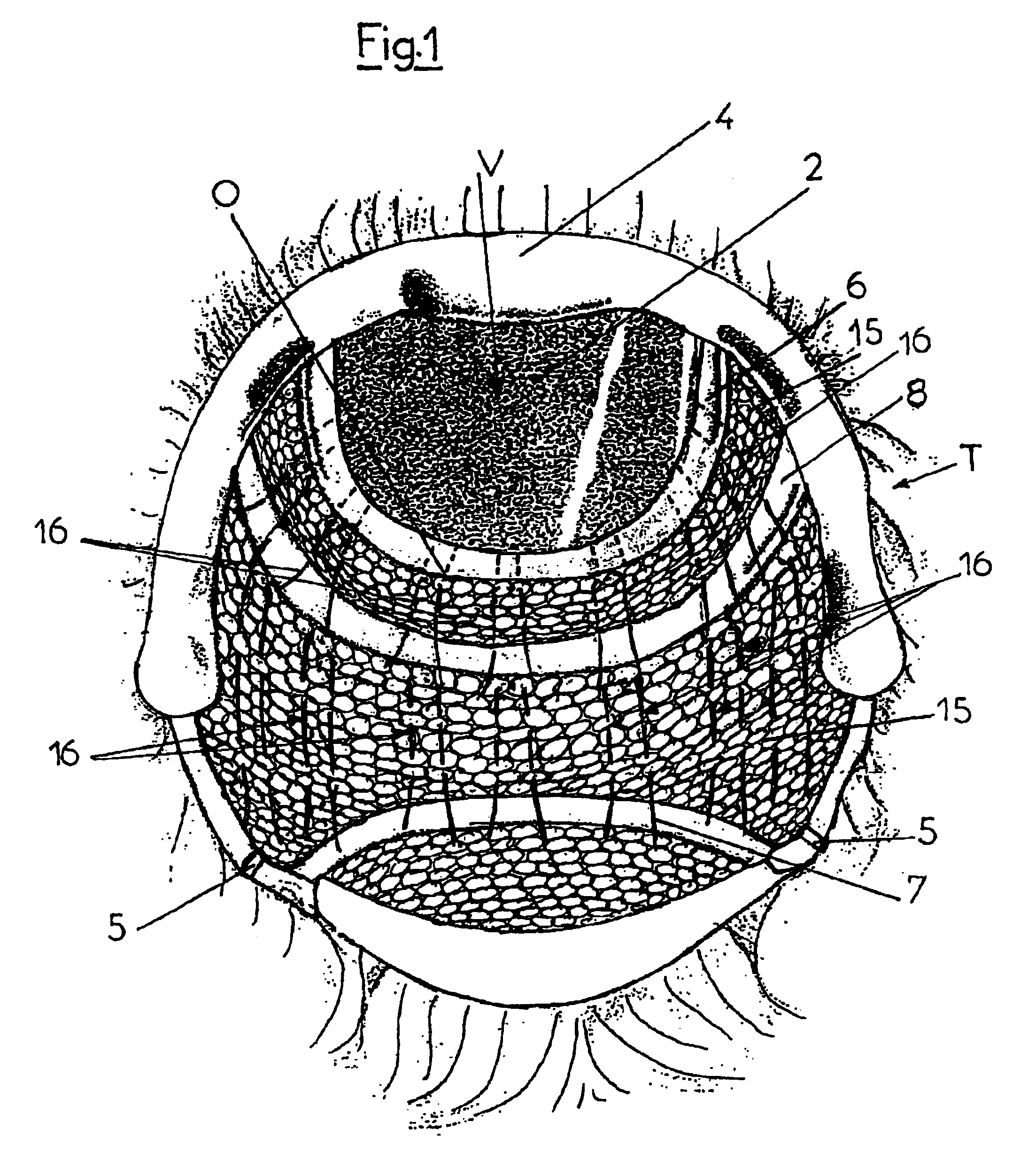 Wig adjustable to the shape of the user's head and method for carrying out said adjustment