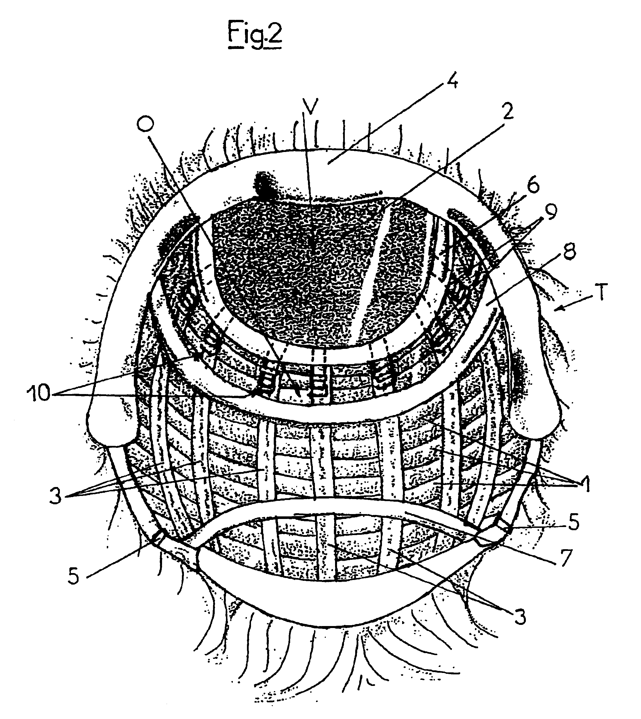 Wig adjustable to the shape of the user's head and method for carrying out said adjustment