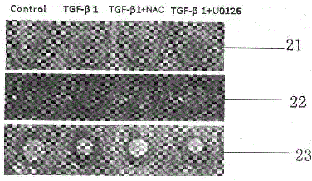 Preparation method of three-dimensional contraction model for constructing artificial blood vessel model