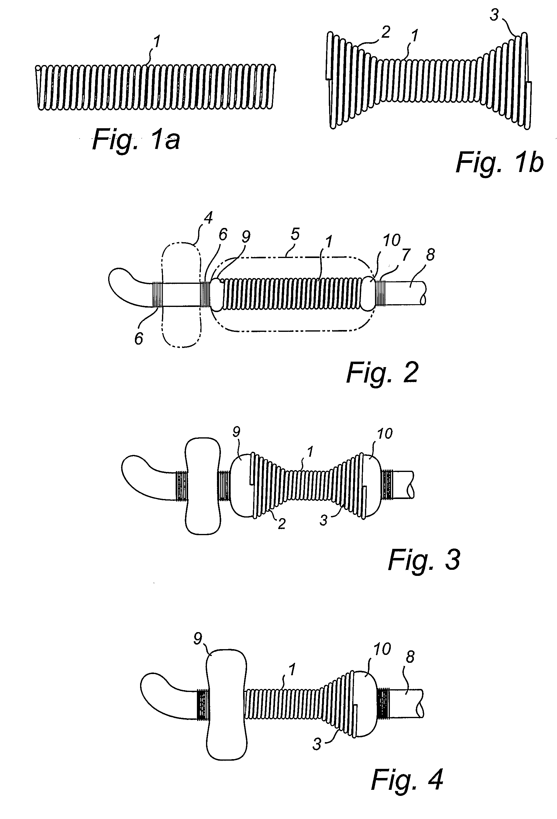 Balloon Catheter