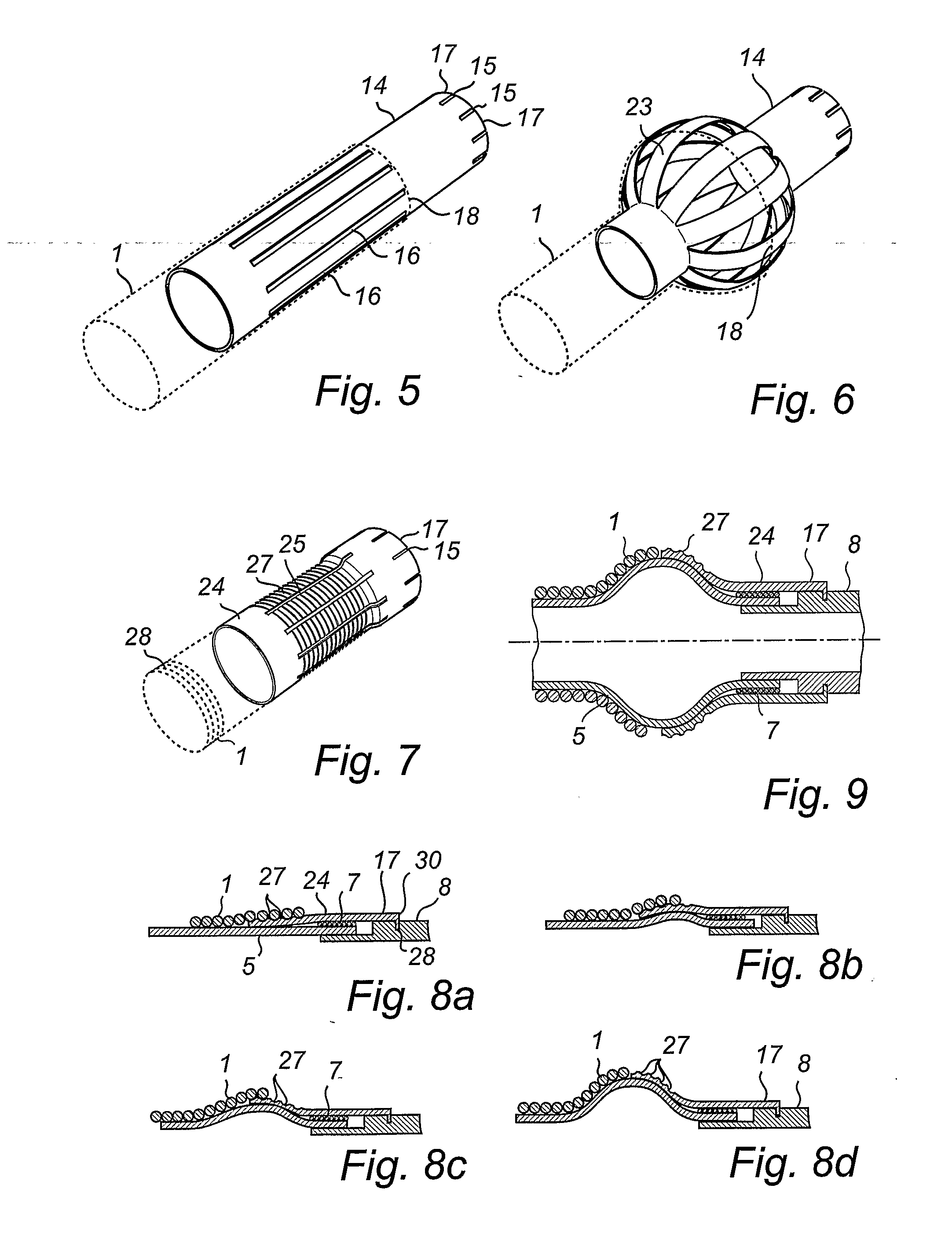 Balloon Catheter