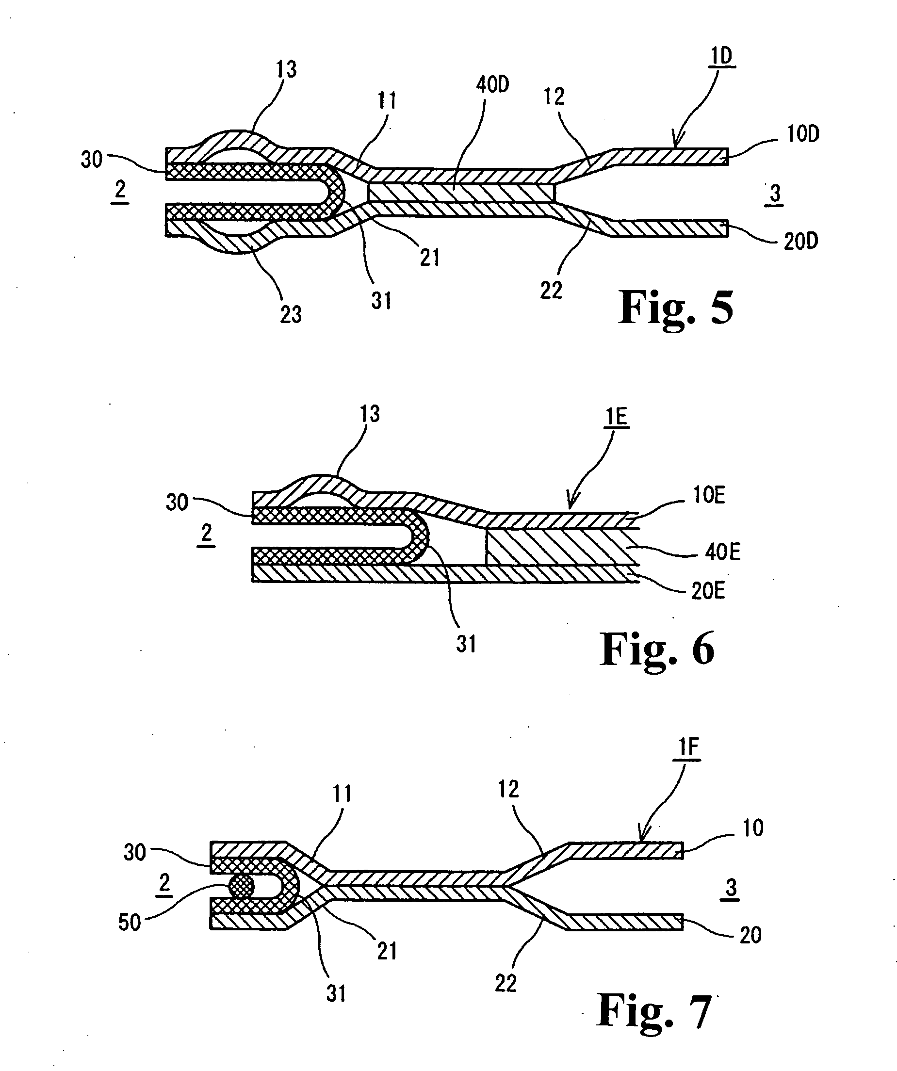 Metal gasket