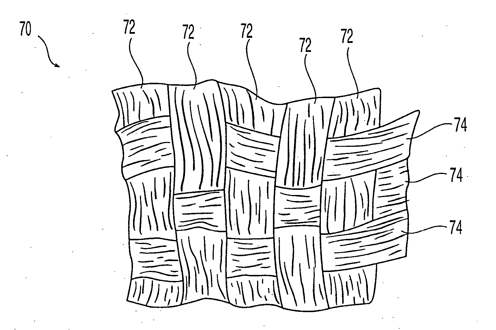 Demineralized bone-derived implants