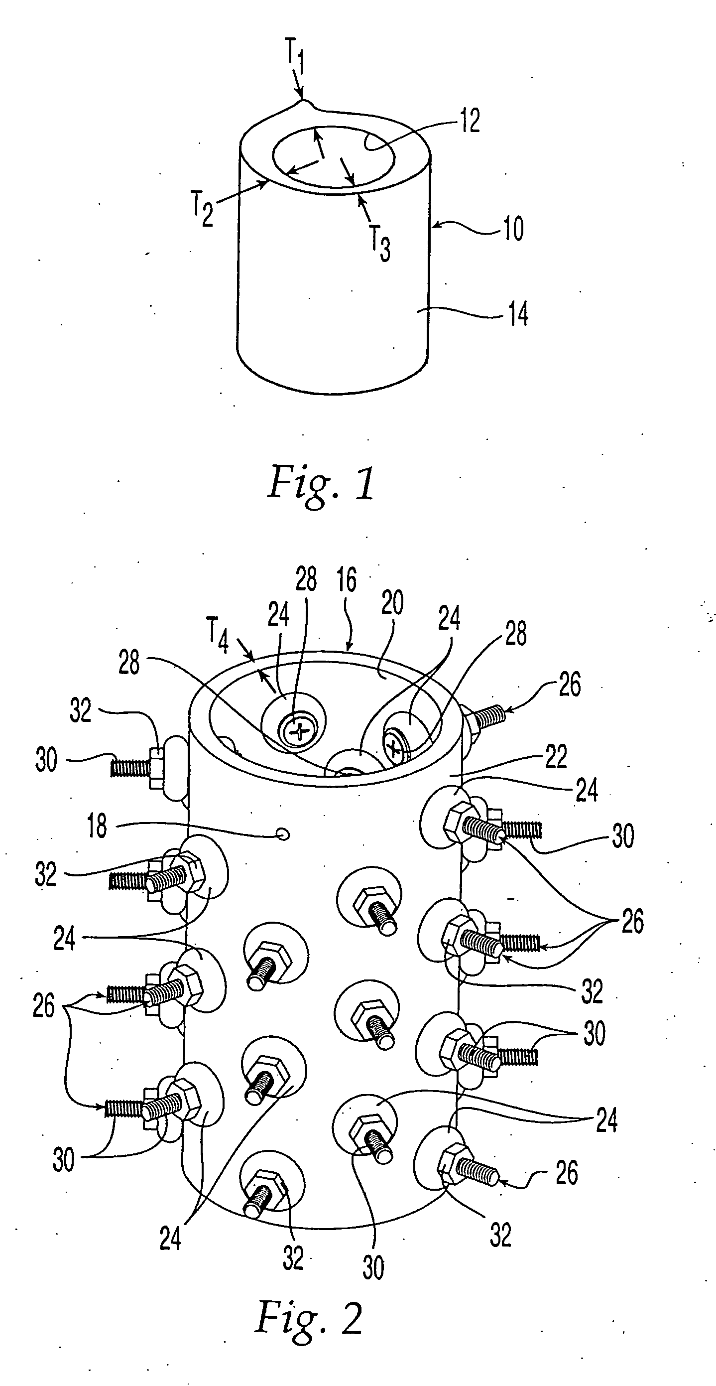 Demineralized bone-derived implants