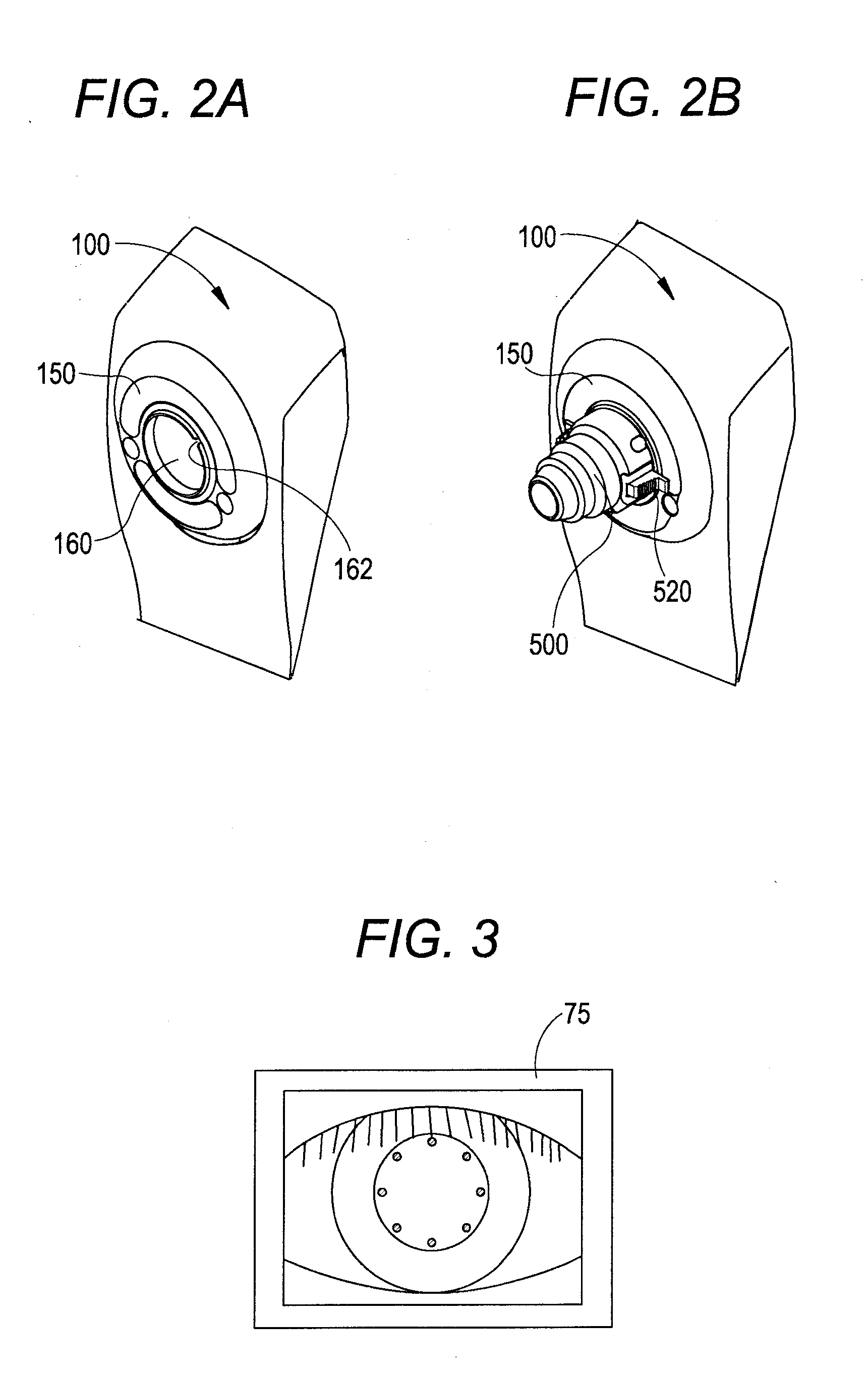 Ophthalmic photographing apparatus