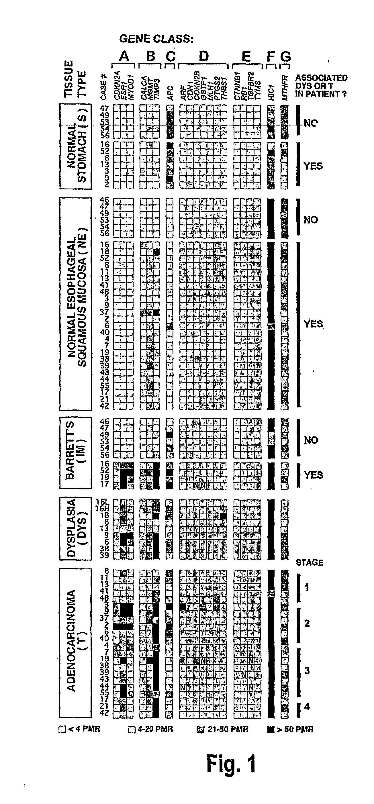 Epigenetic sequences for esophageal adenocarcinoma