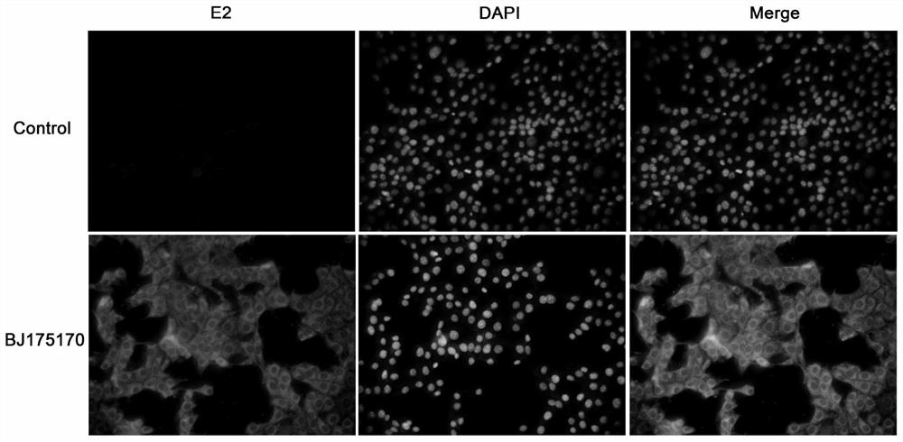 Bovine viral diarrhea virus BVDV-BJ175170 and application thereof