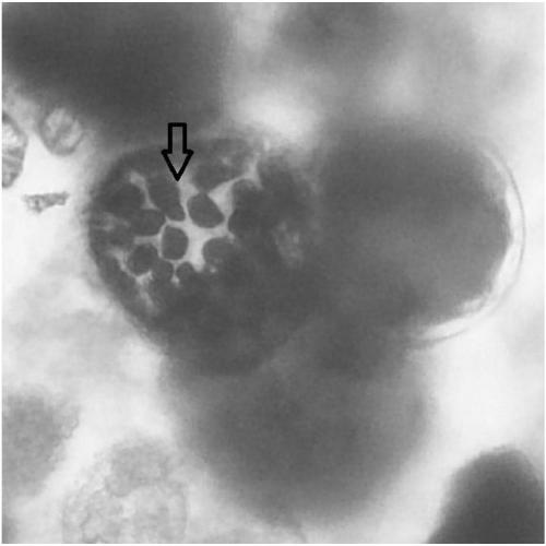 Preparation method of ginseng stem cells