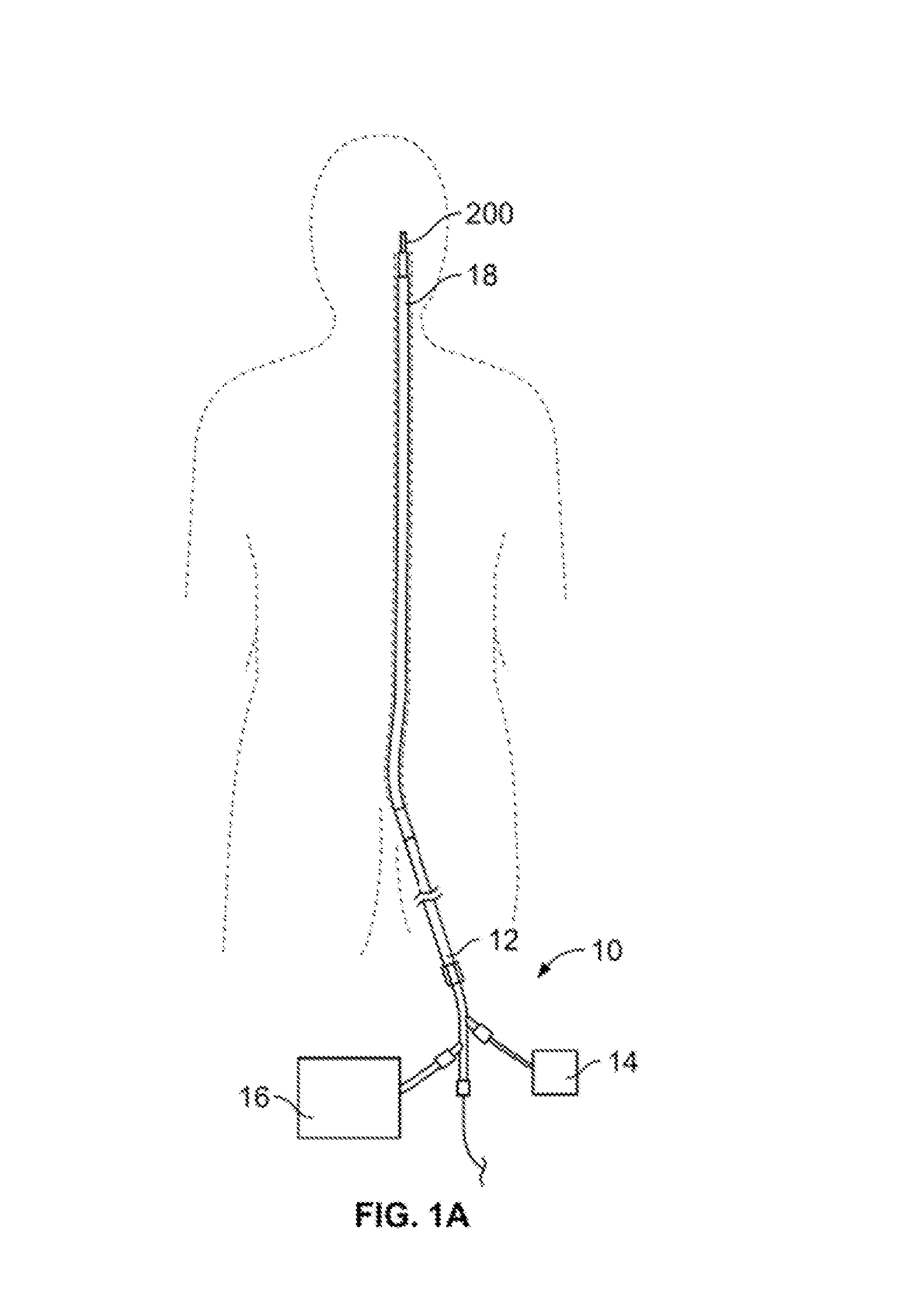 Retrieval systems and methods for use thereof