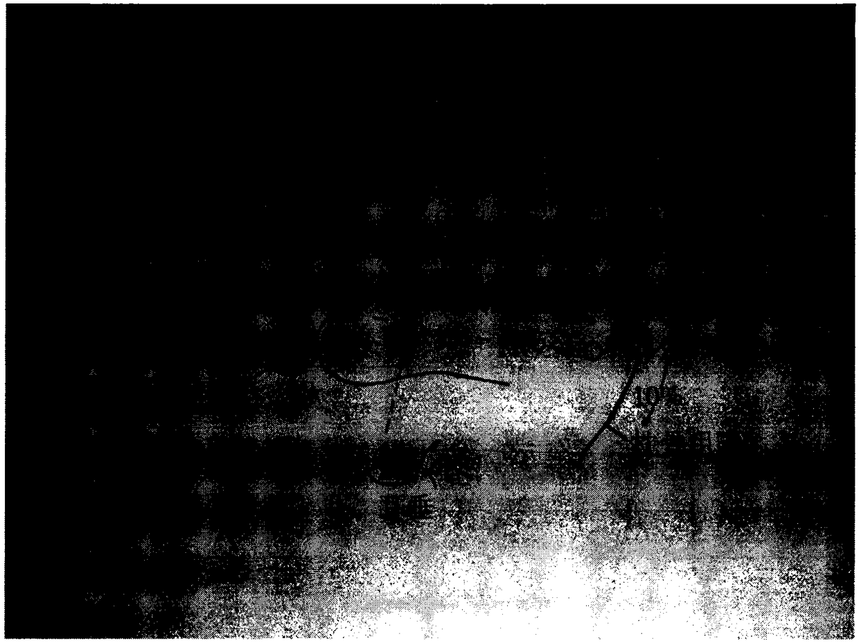 Device and method for determining electrode placement position for scalp electroencephalography