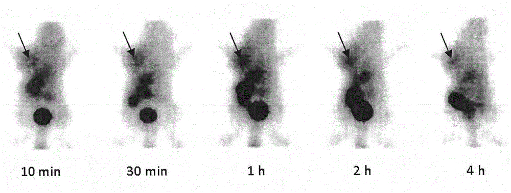 Technetium-99m-labelled colchicine complex, preparation method thereof and purpose thereof