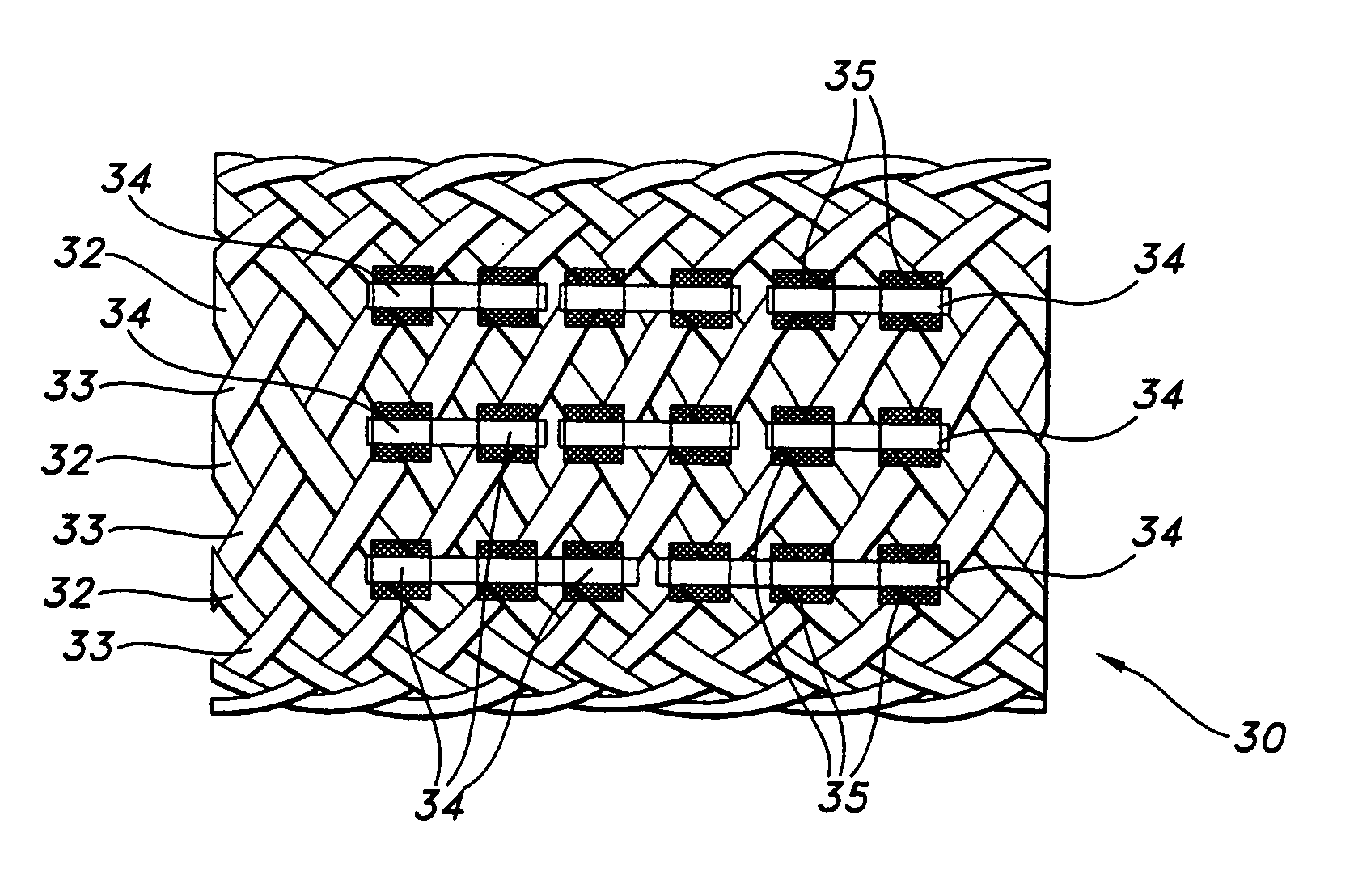 Biodegradable implants having accelerated biodegradation properties in vivo