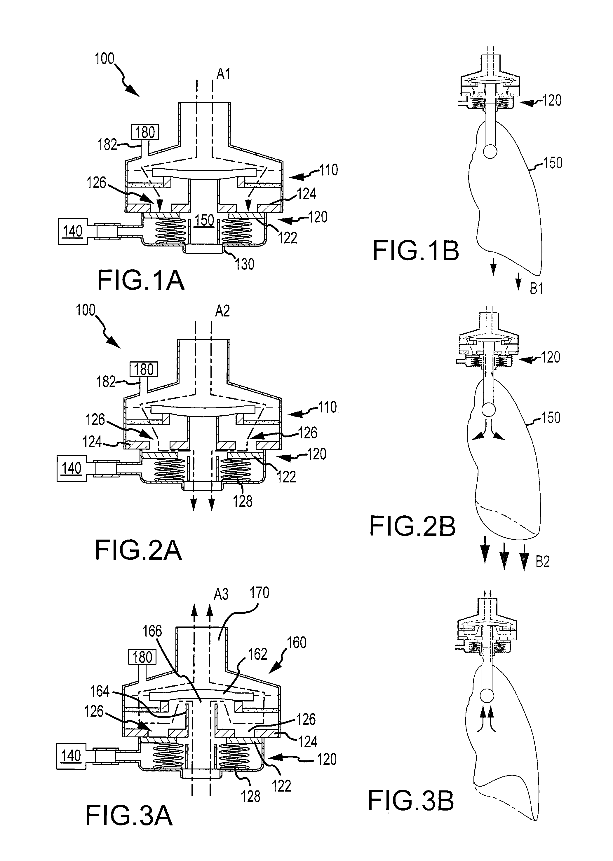 Method and system to decrease intracranial pressure, enhance circulation, and encourage spontaneous respiration