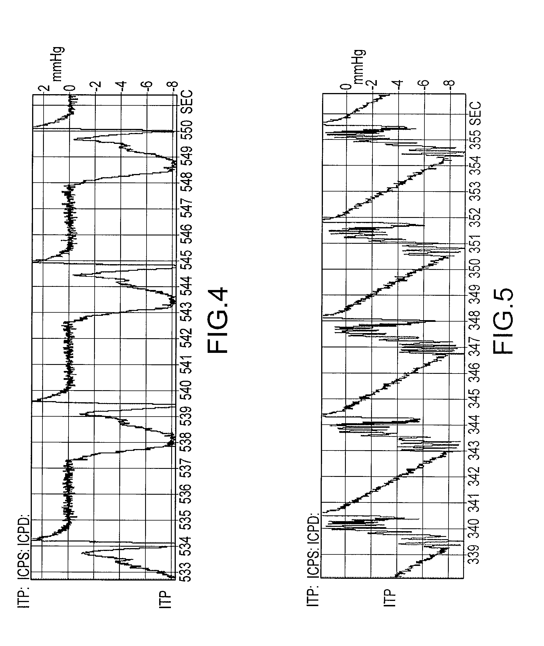 Method and system to decrease intracranial pressure, enhance circulation, and encourage spontaneous respiration