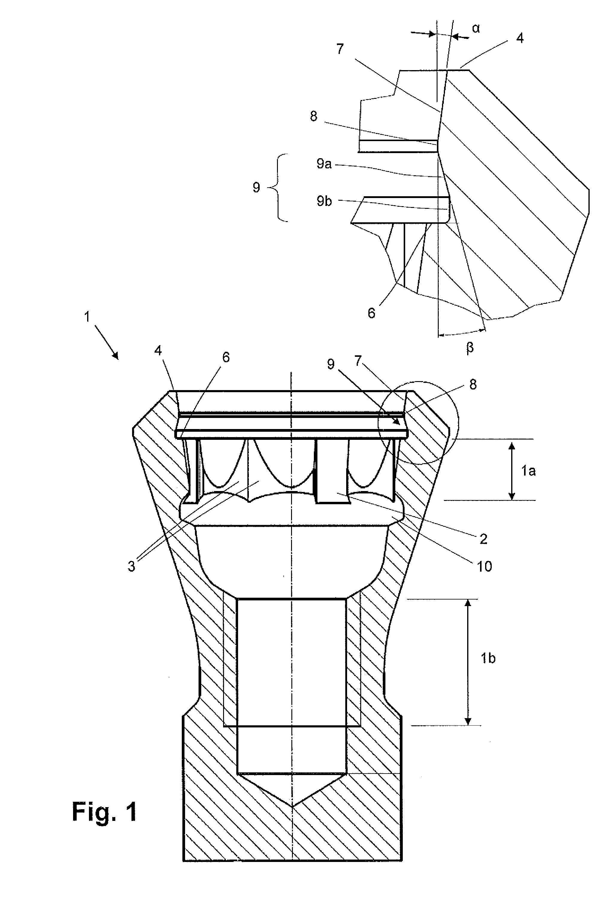 Dental implant socket arrangement with annular recess