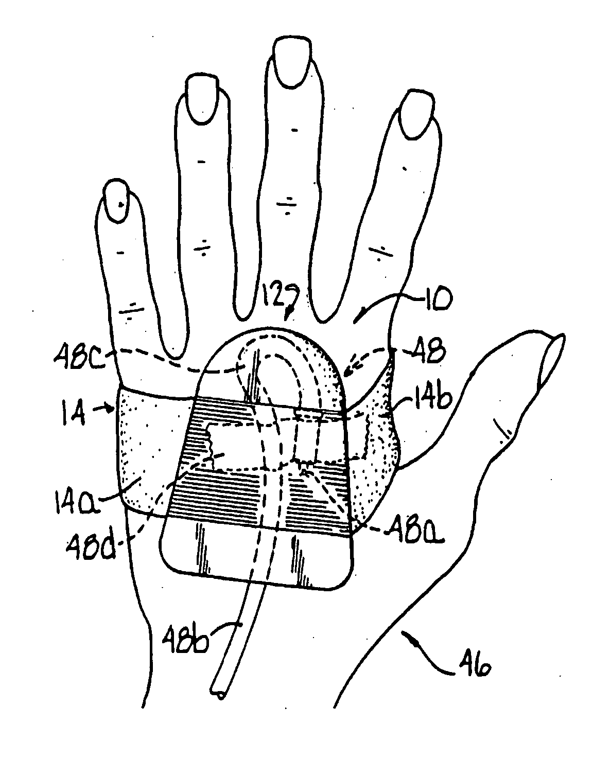 Site guard for intravenous sites and other sensitive areas