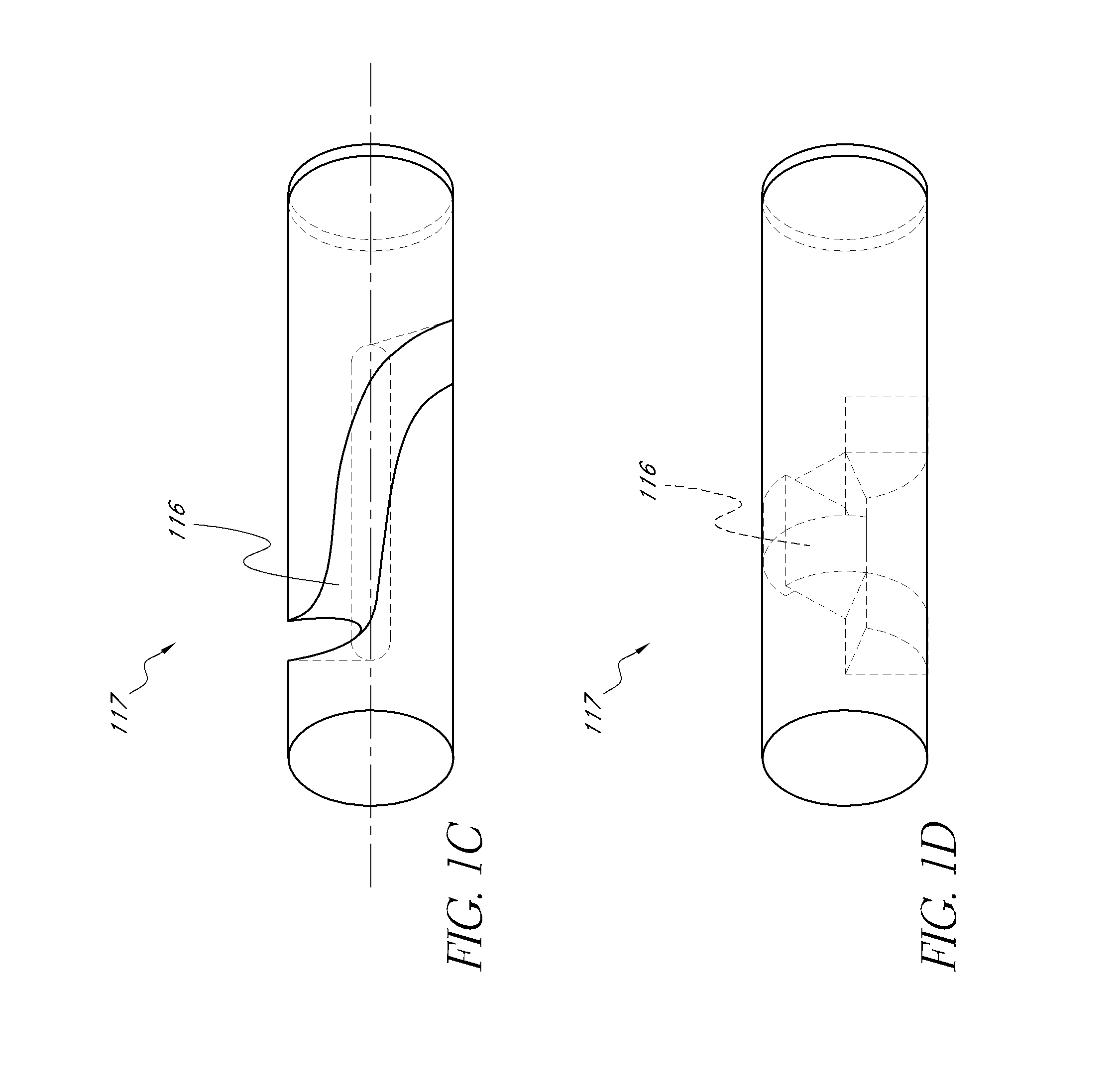 Optical sensor configuration and methods for monitoring glucose activity in interstitial fluid