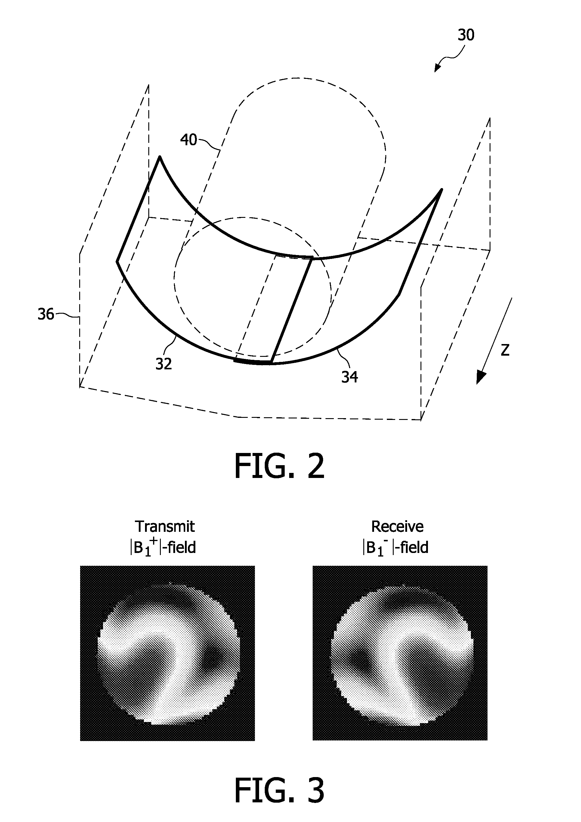 Transmit/receive coil for ultra-high field MRI