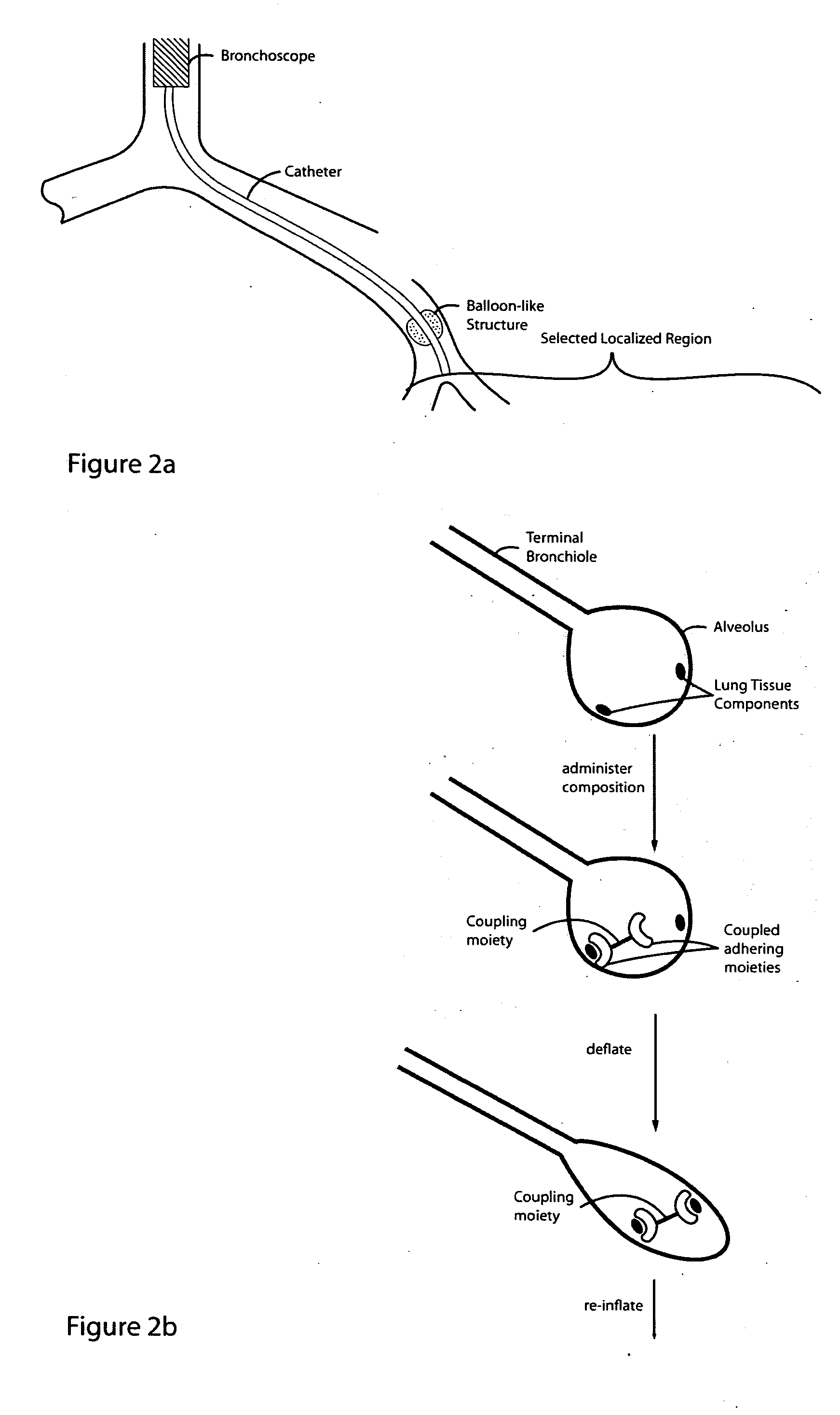 Glue composition for lung volume reduction