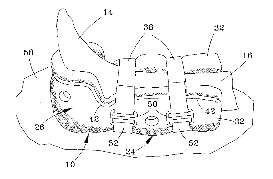 Heel-supporting protective boot