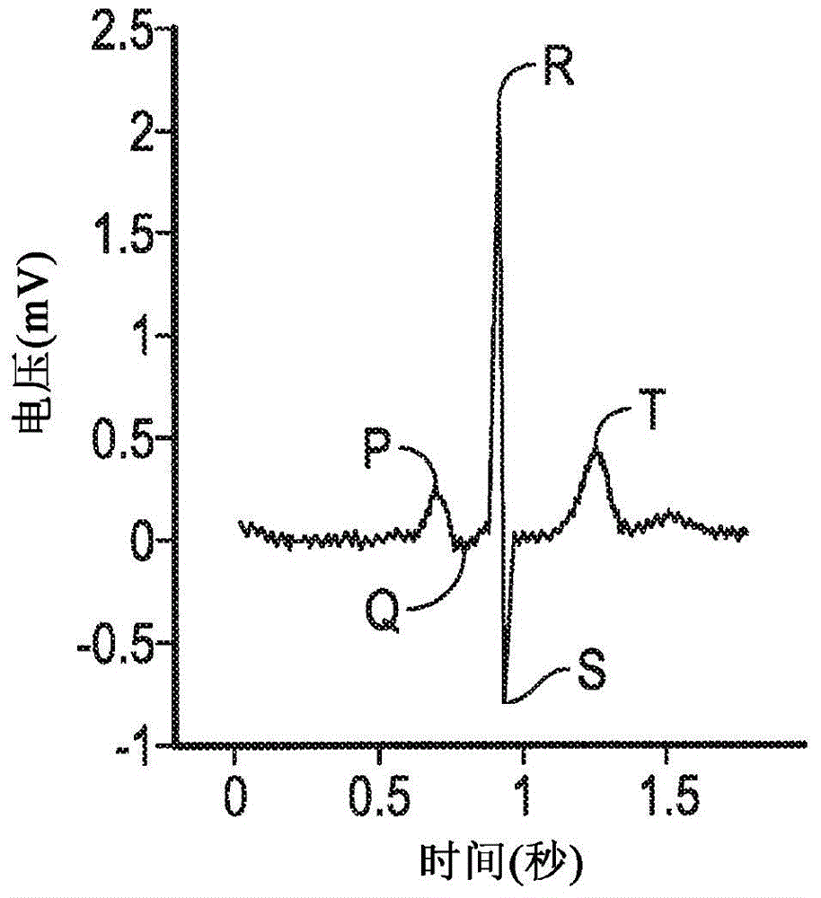 System and method for analysis and reconstruction of variable pulse-width signals having low sampling rates