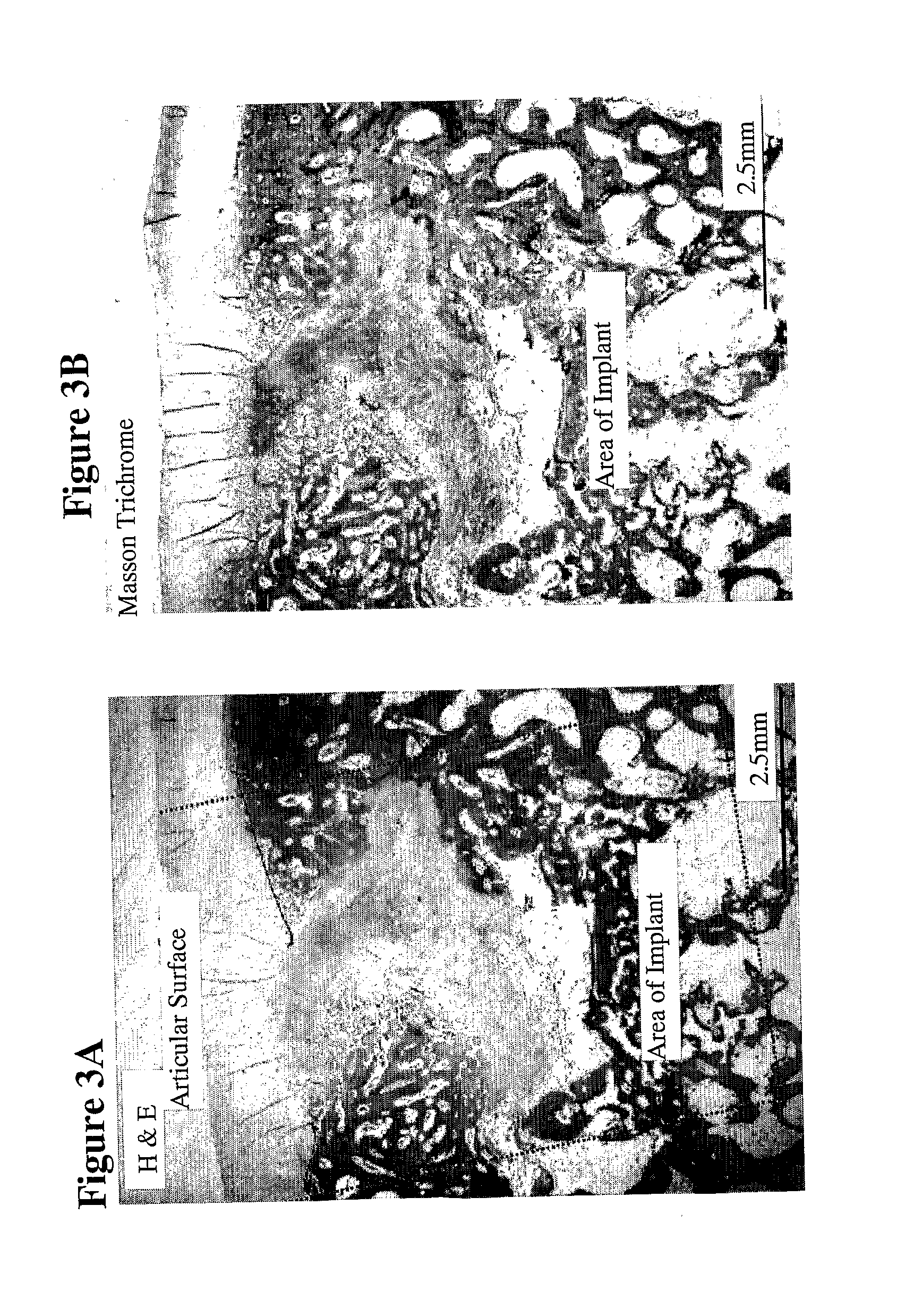 Solid Forms for Tissue Repair