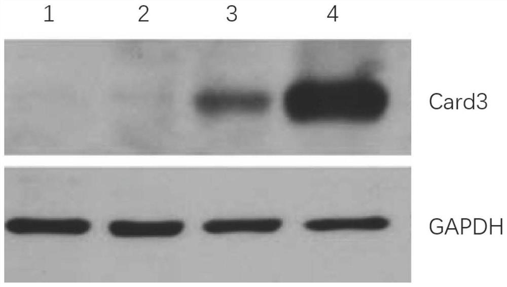 Knockout of Card3 gene in epidermal stem cells using CRISPR-Cas system