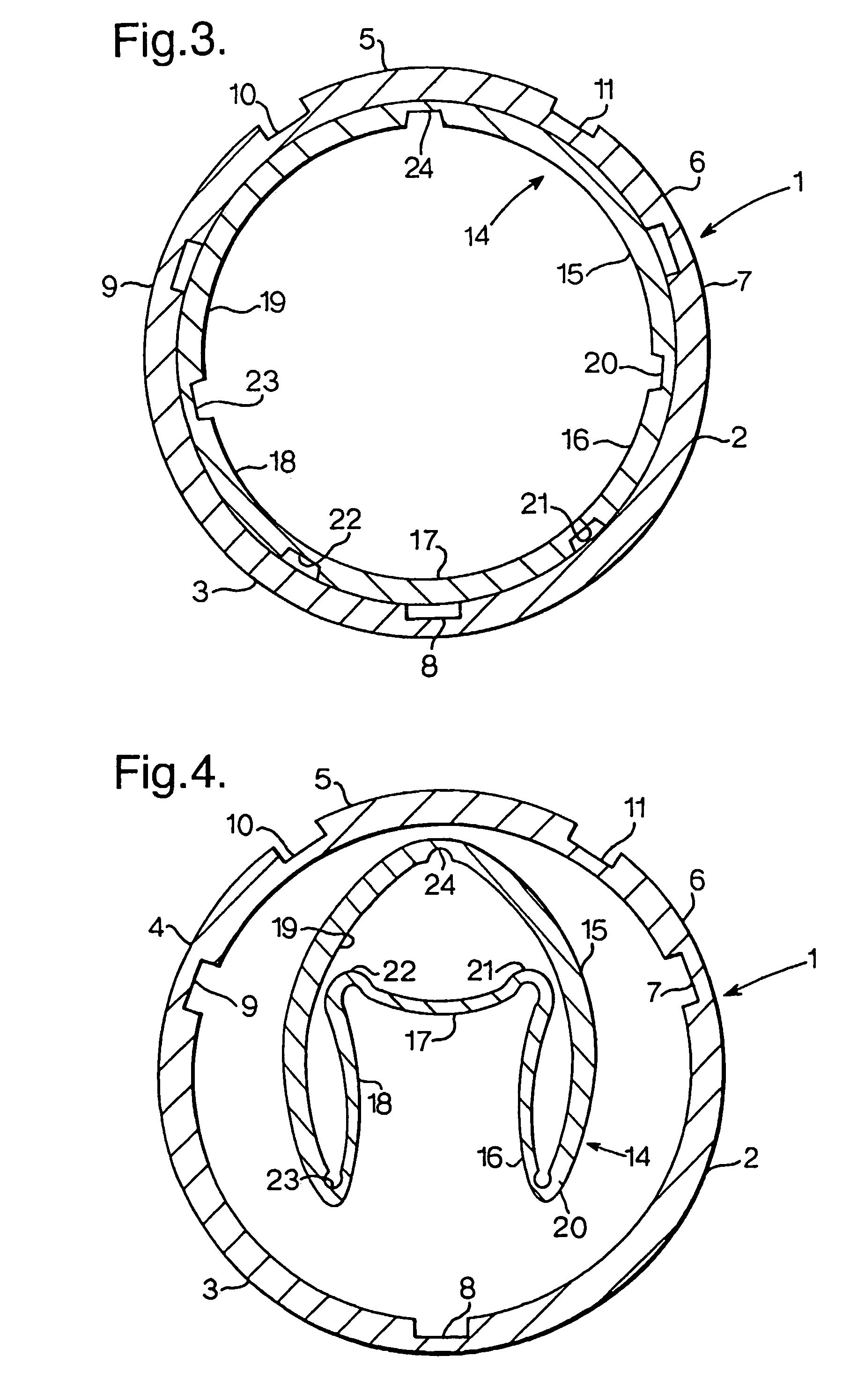 Contractable and expandable tubular wellbore system