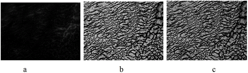 Targeting molecular imaging probe and living molecular imaging method